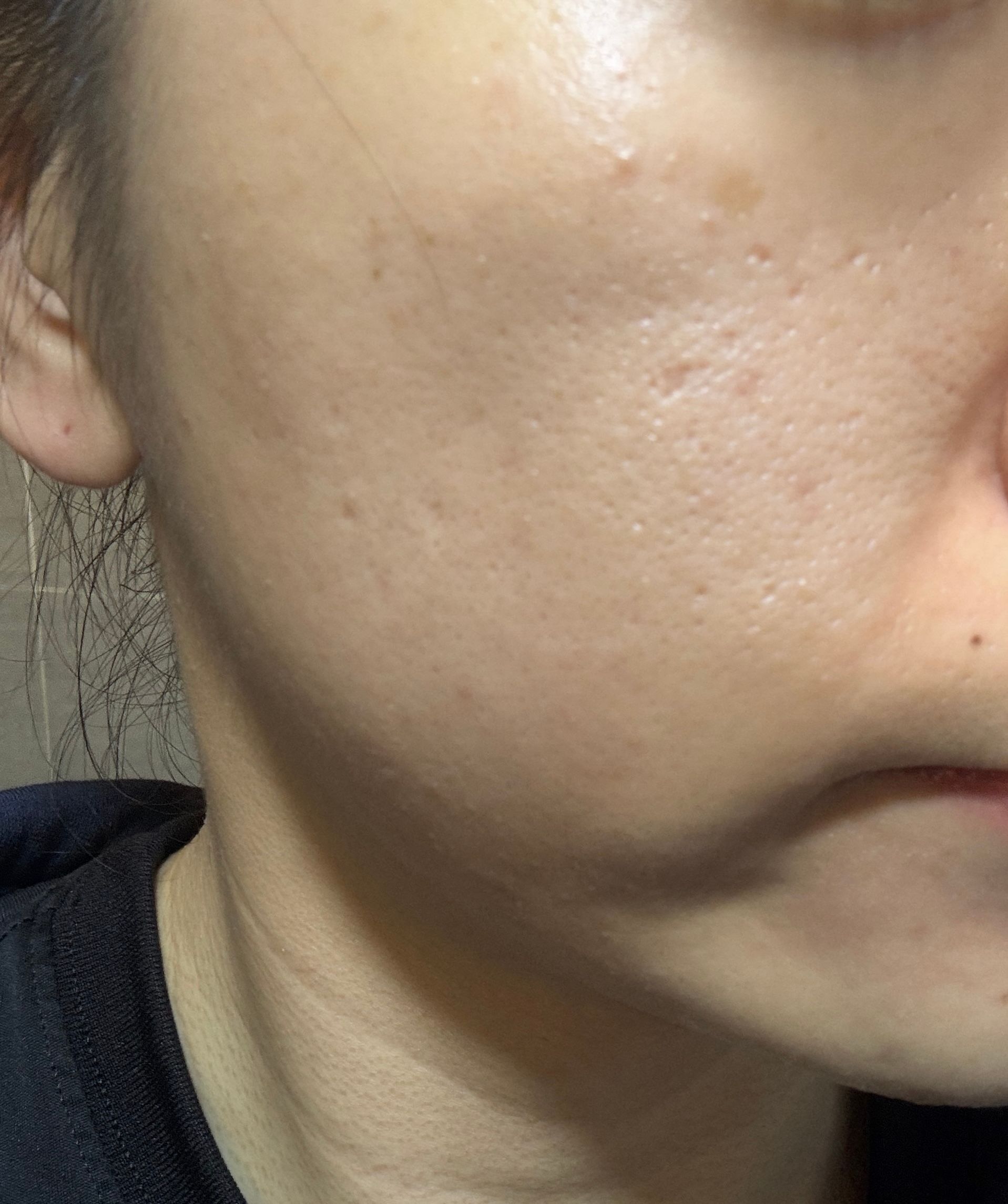 Skin Need 05I 白藜蘆醇A醇面霜 真實評價/實測照片 byy*y 1