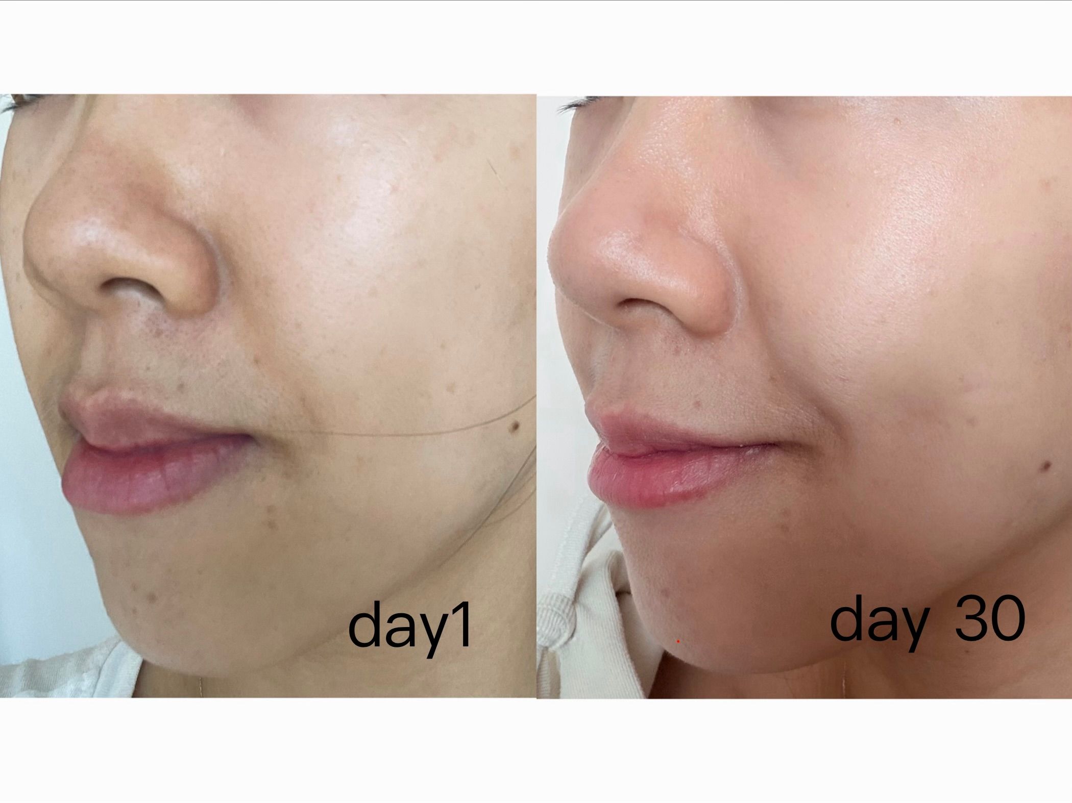 Skin Need 04F 4重維他命C精華 真實評價/實測照片 bysus*********************com 1