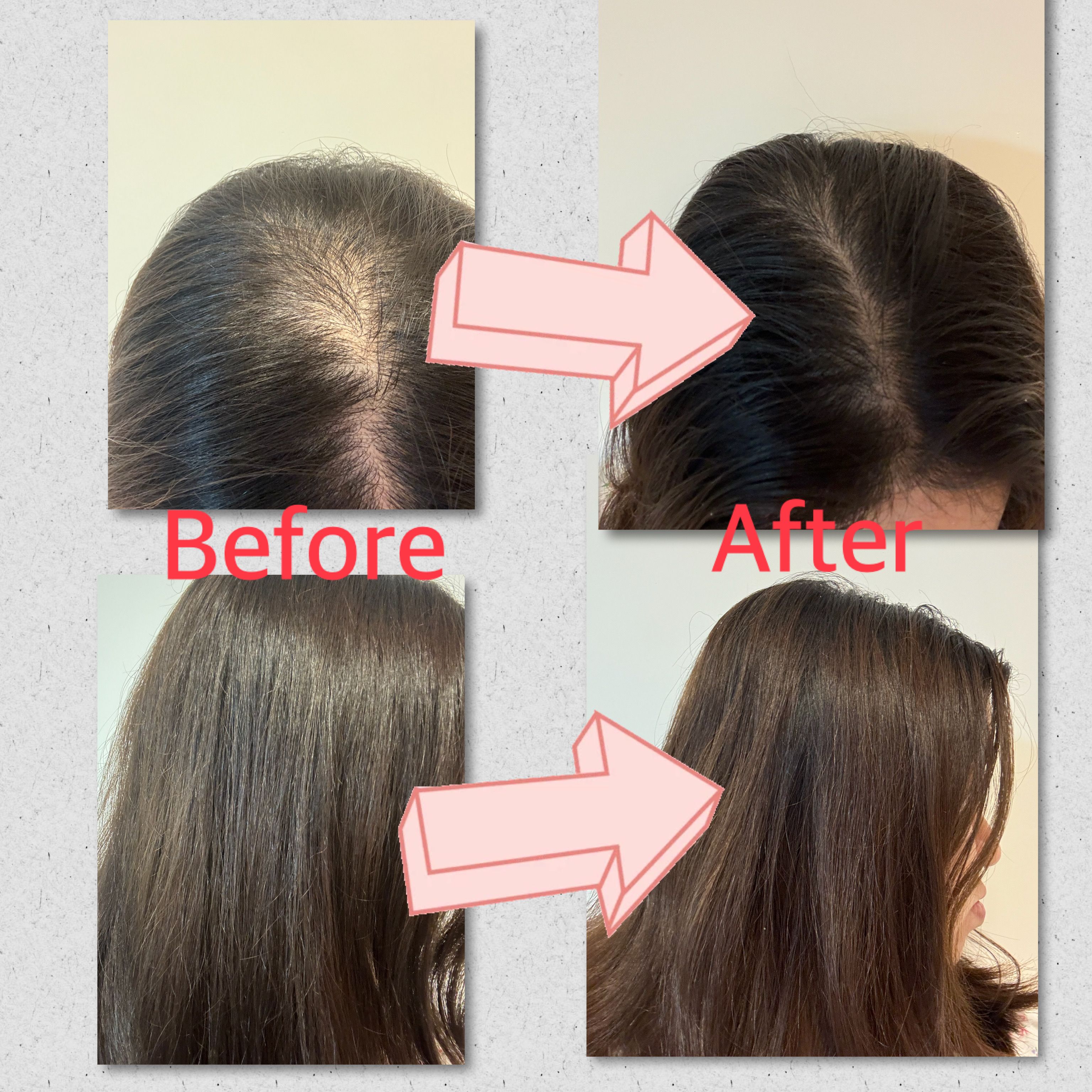 潘婷 Pantene 豐盈防脫頭皮精華 真實評價/用後感 bycya***yan 1 潘婷 Pantene 豐盈防脫頭皮精華 真實評價/實測照片 bycya***yan 1