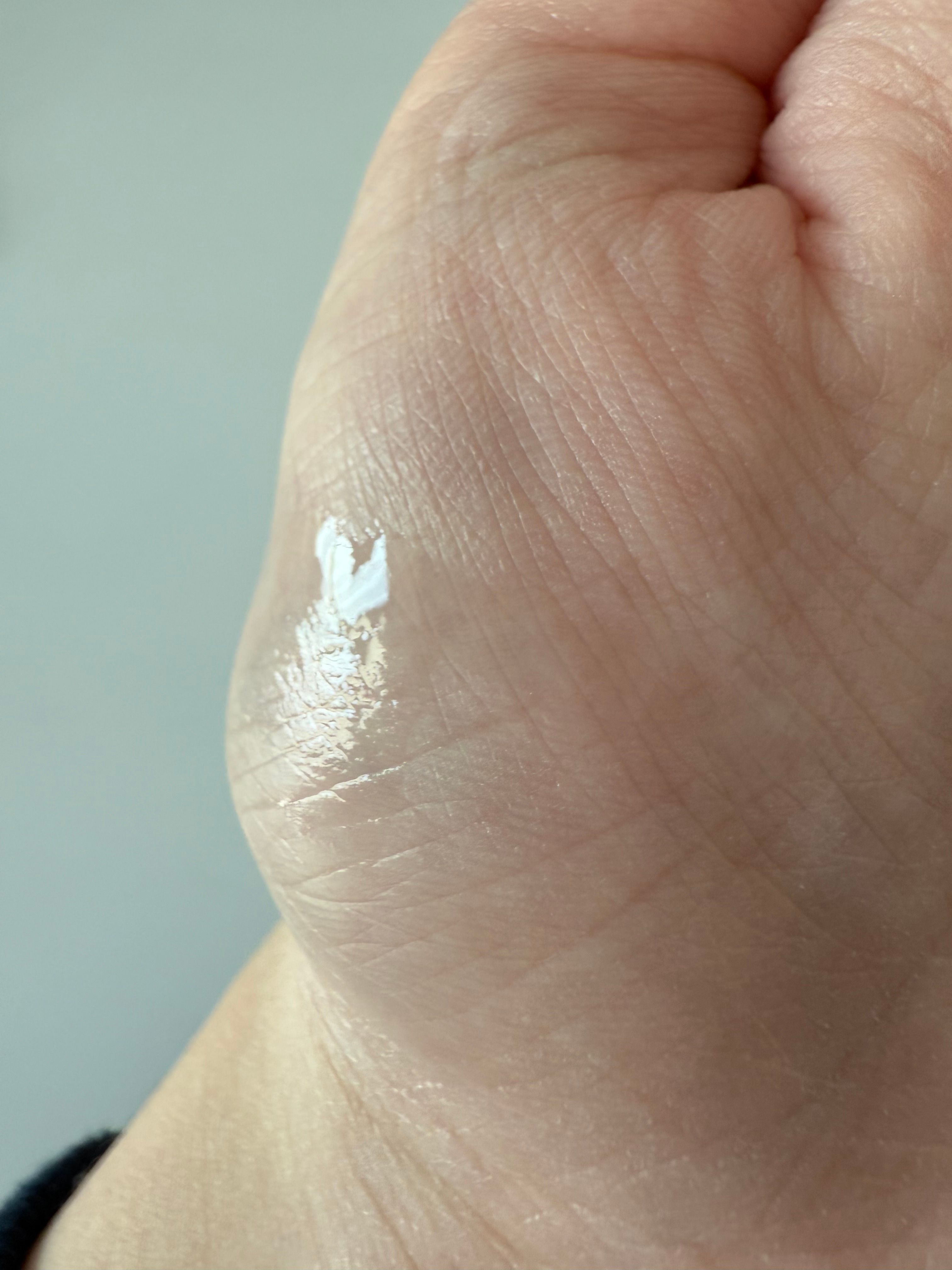 ANUA 77% 魚腥草爽膚水 (77%魚腥草舒緩鎮靜保濕爽膚水) 真實評價/實測照片 bylo****ne 1