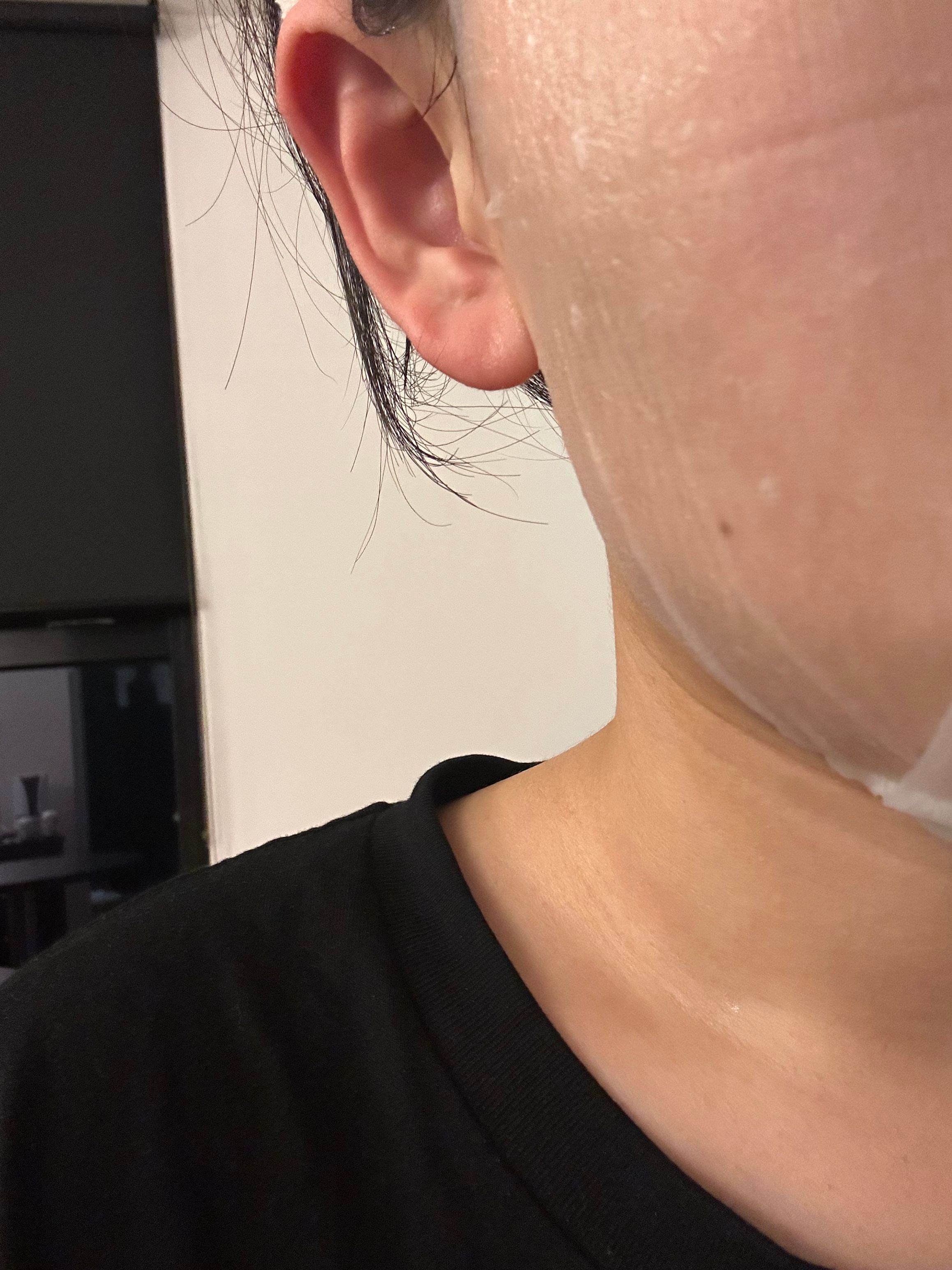 JM Solution 水滋養急救安瓶透明質酸面膜 真實評價/用後感 byVen***Lee 1 JM Solution 水滋養急救安瓶透明質酸面膜 真實評價/實測照片 byVen***Lee 1