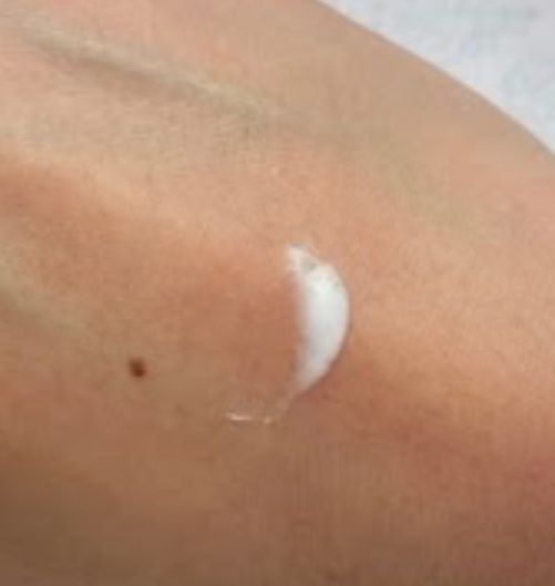 Lion 獅王 Pair暗瘡膏 真實評價/實測照片 bylau******************com 1