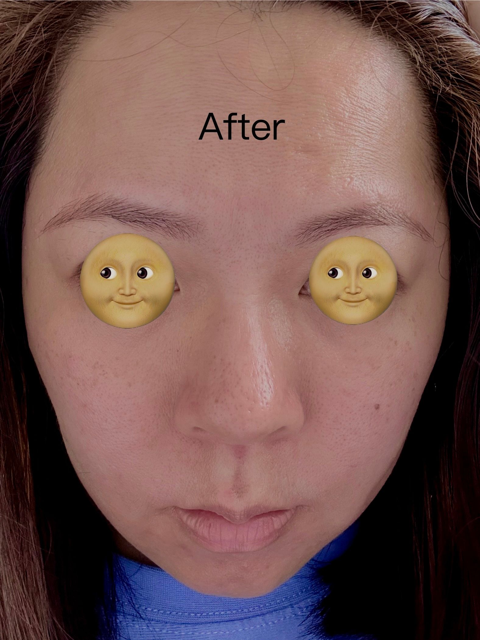 Medicube RED積雪草修復面膜 真實評價/實測照片 bydor***************com 2