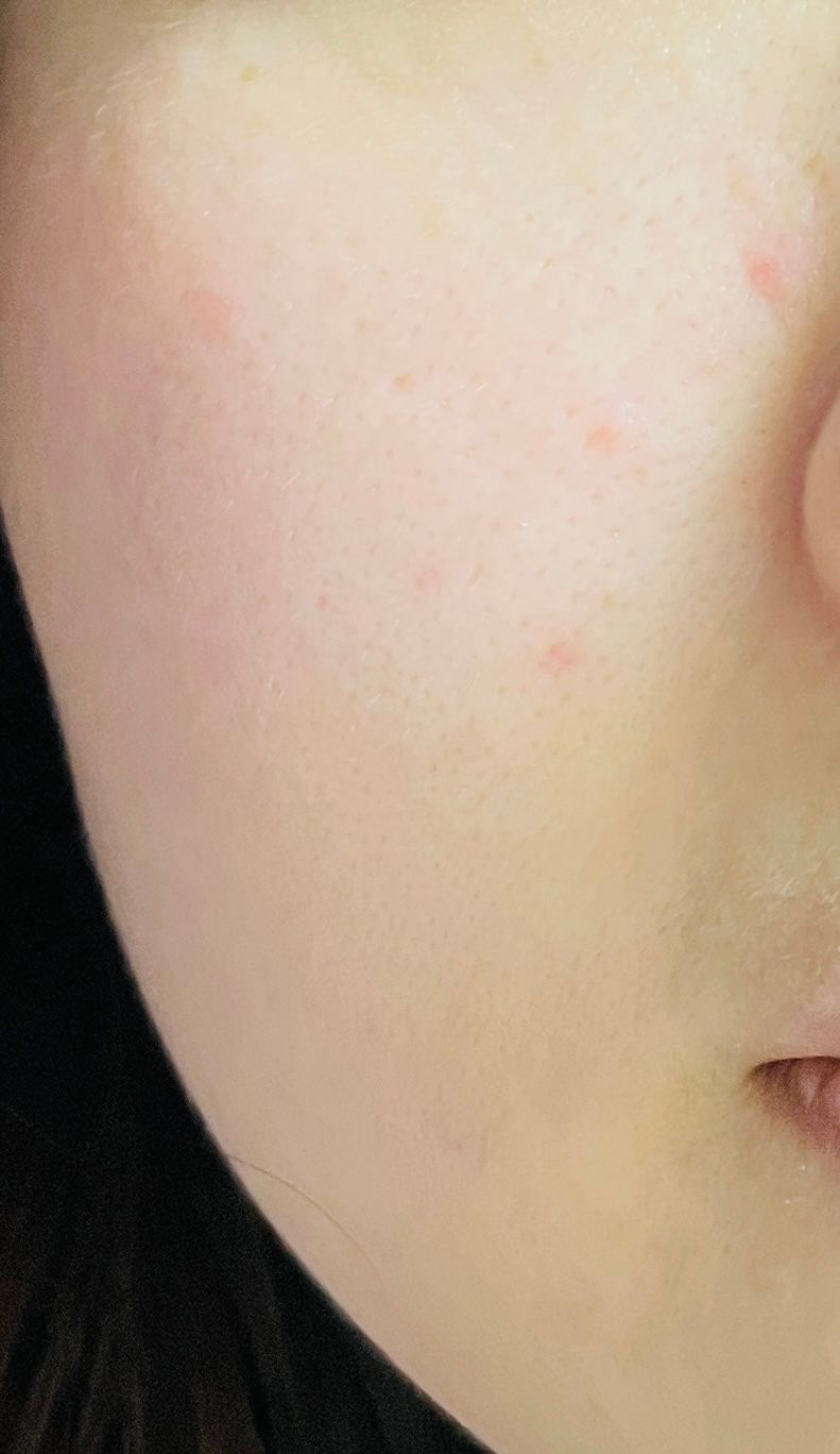 Sasatinnie 第三代升級版全效水潤透光面膜 真實評價/實測照片 byThe*******zon 2