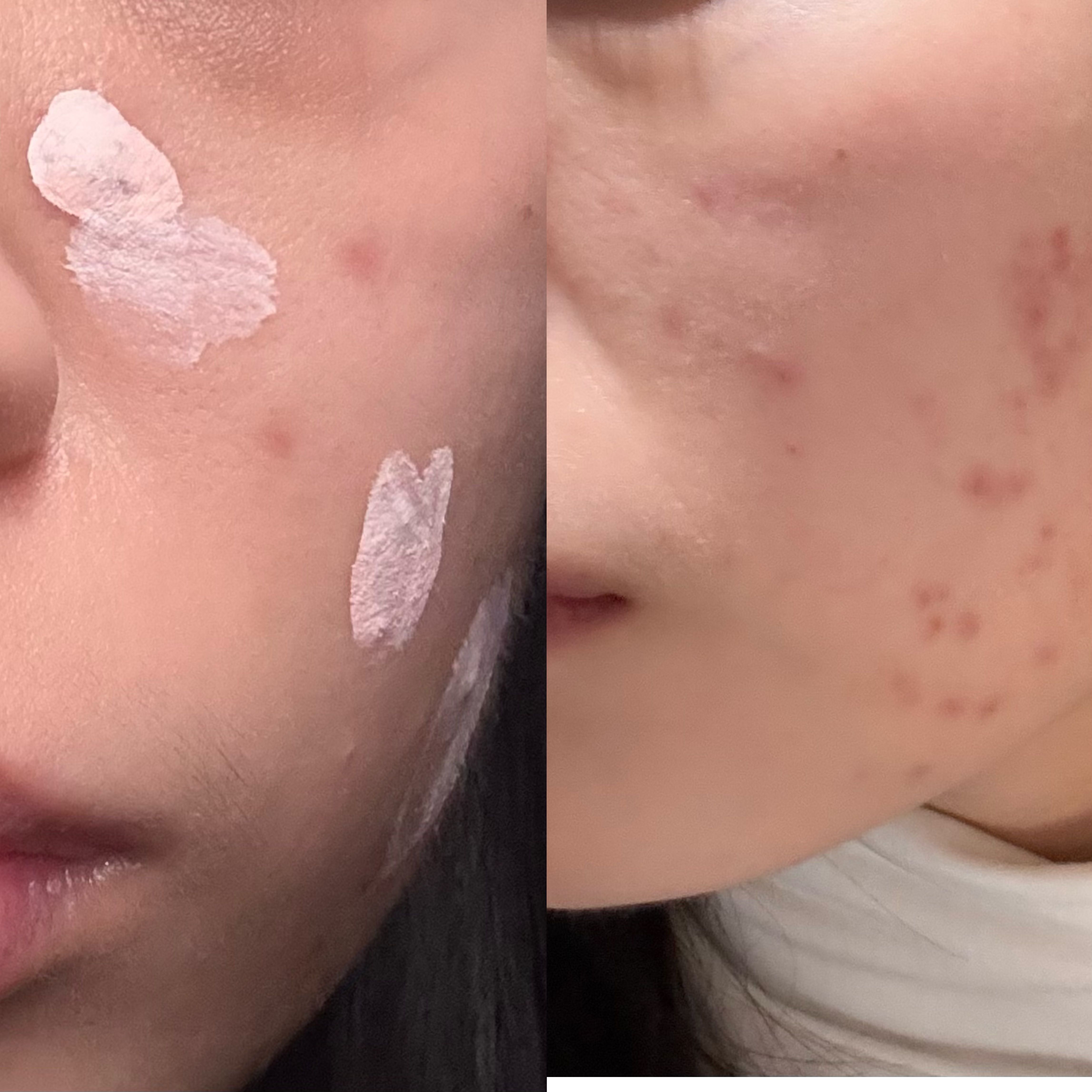 Mario Badescu 祛痘精華溫和版 真實評價/實測照片 byPig**********die 1