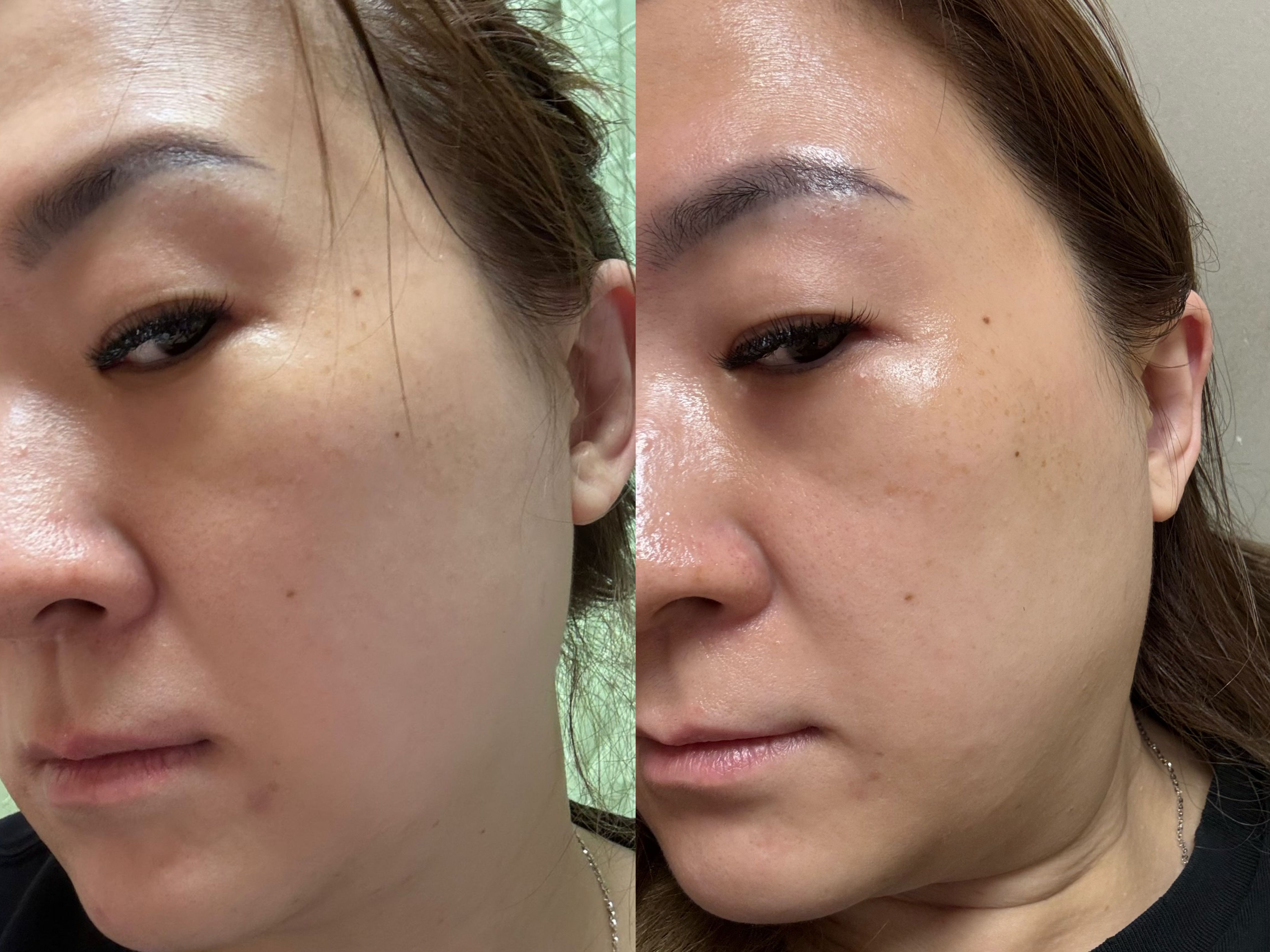 Sasatinnie 第三代升級版全效水潤透光面膜 真實評價/實測照片 bydeb******************com 1