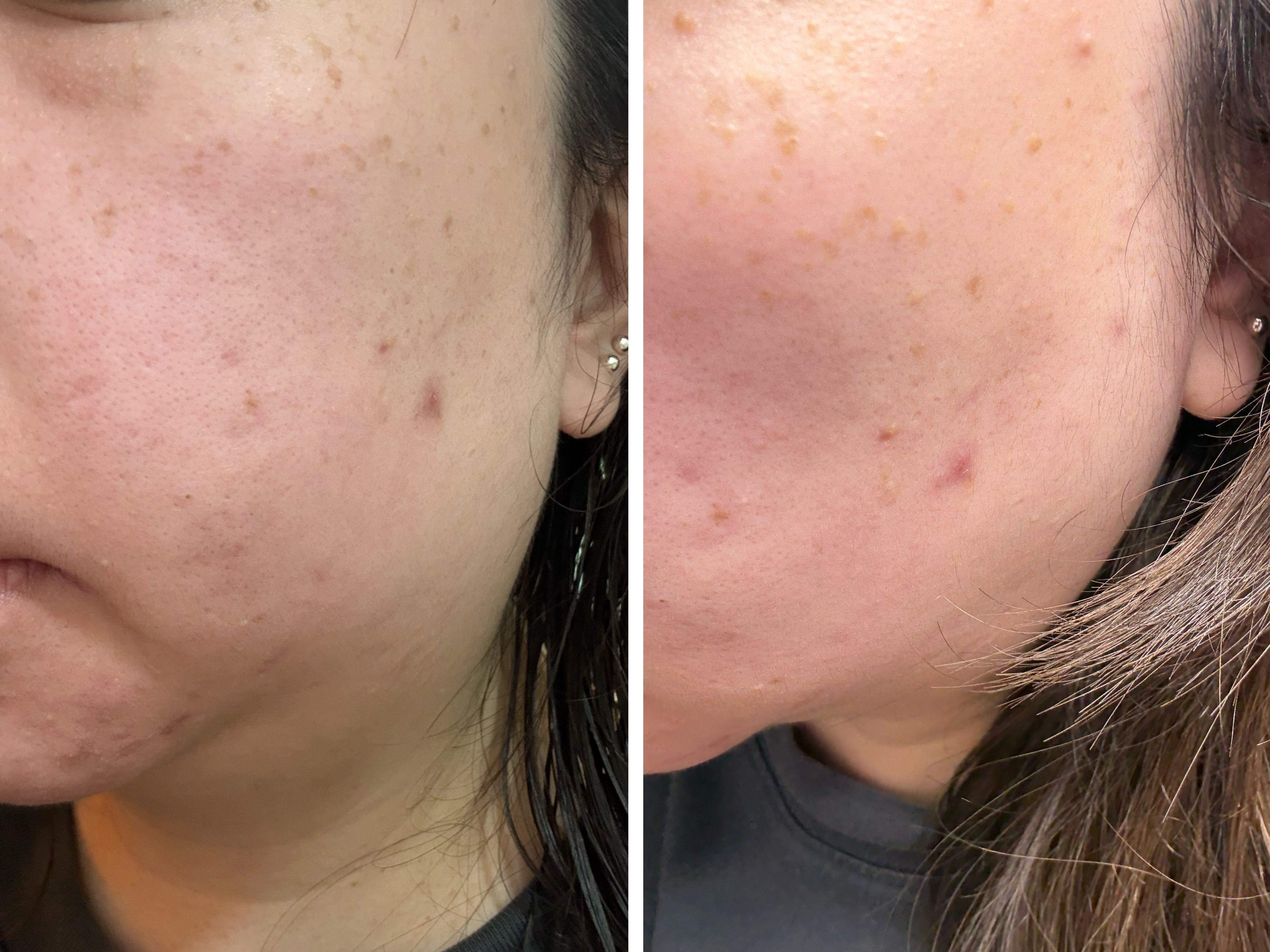 Sasatinnie 第三代升級版全效水潤透光面膜 真實評價/實測照片 byC***y 1