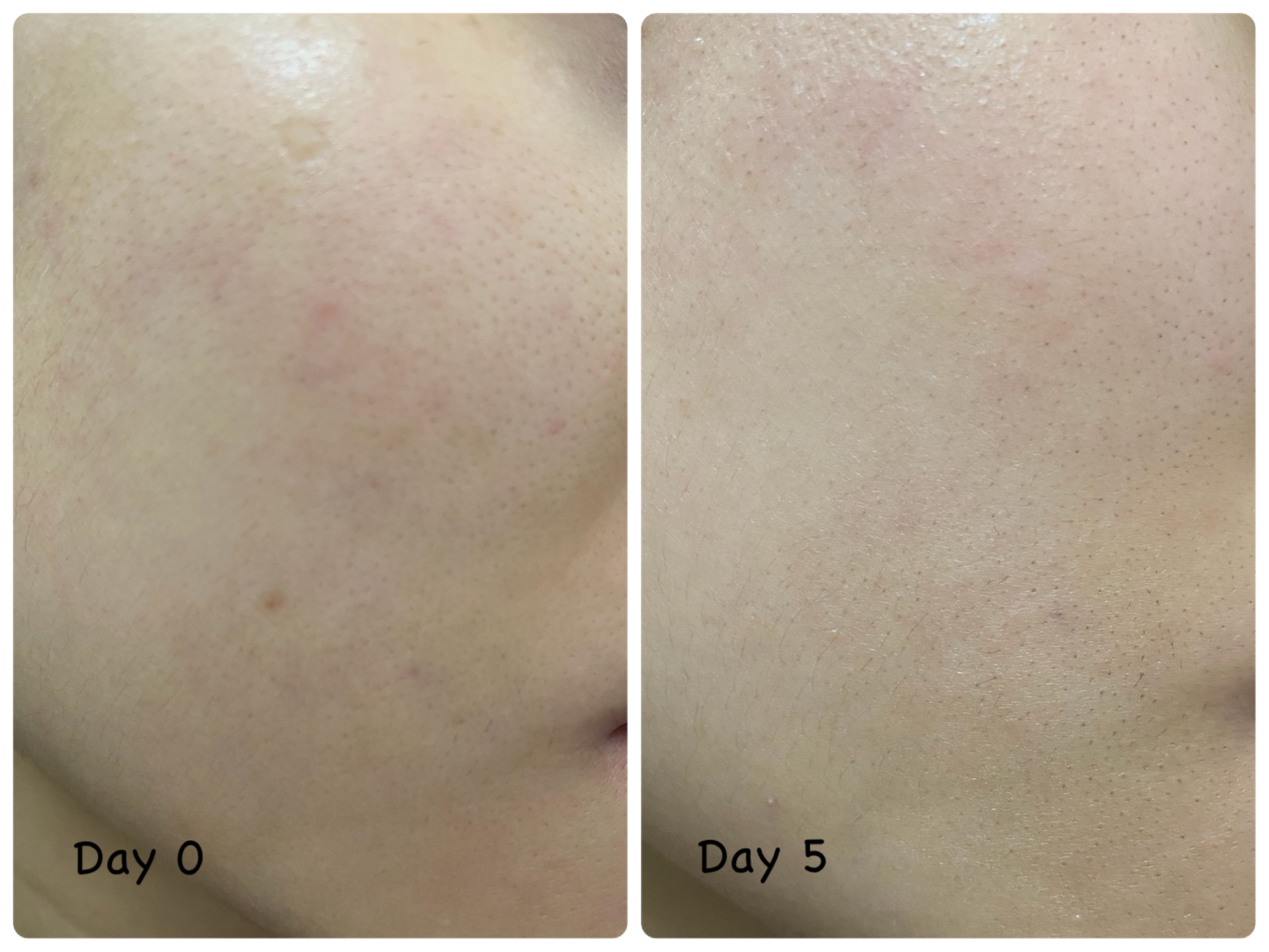 Sasatinnie 第三代升級版全效水潤透光面膜 真實評價/實測照片 byY*N 1