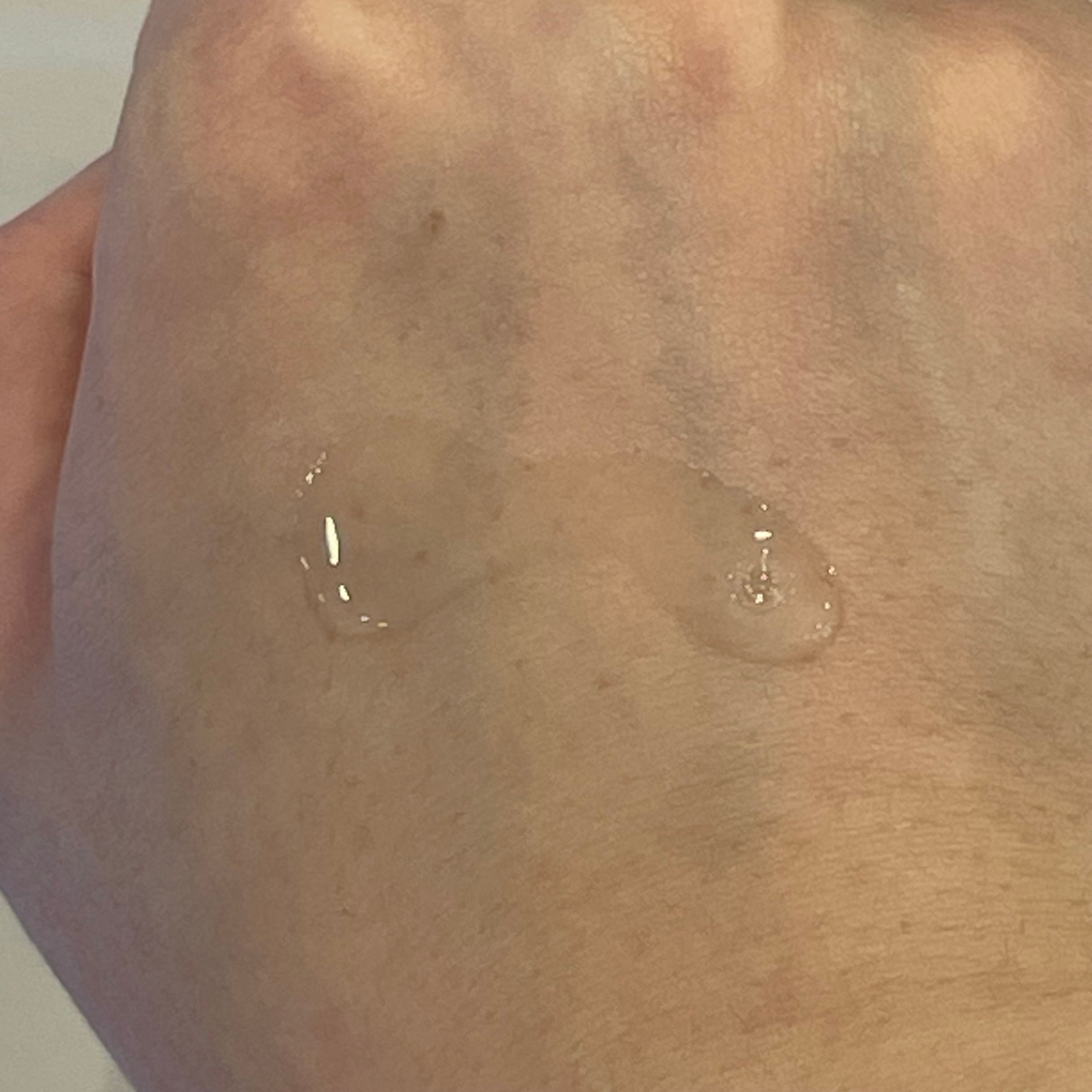 AHC 醫美科研水光導入玻尿酸化妝水 真實評價/實測照片 byS**f 1