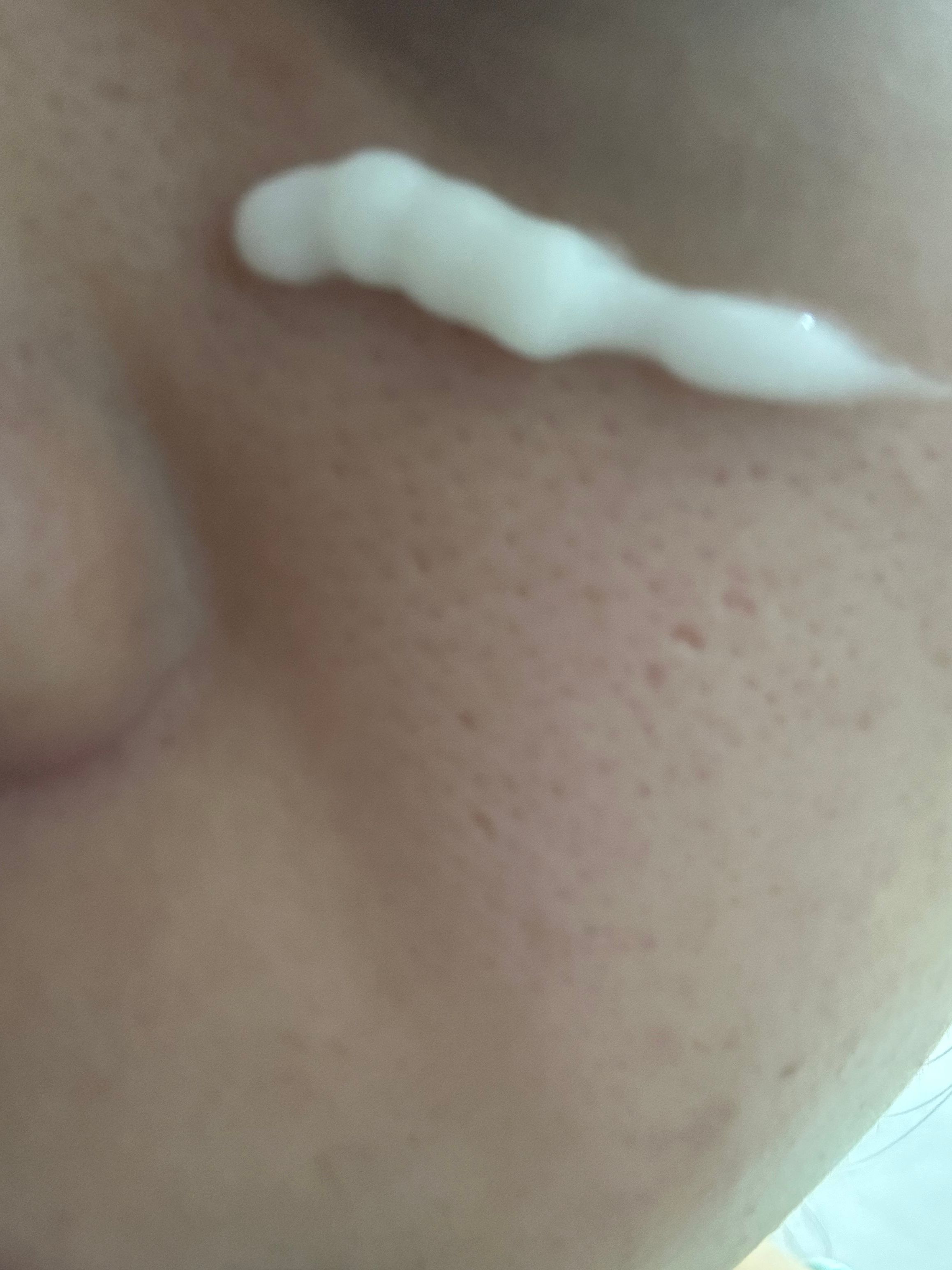 NEUE 法國塗抹式水光嬰兒針 真實評價/實測照片 byA*c 1