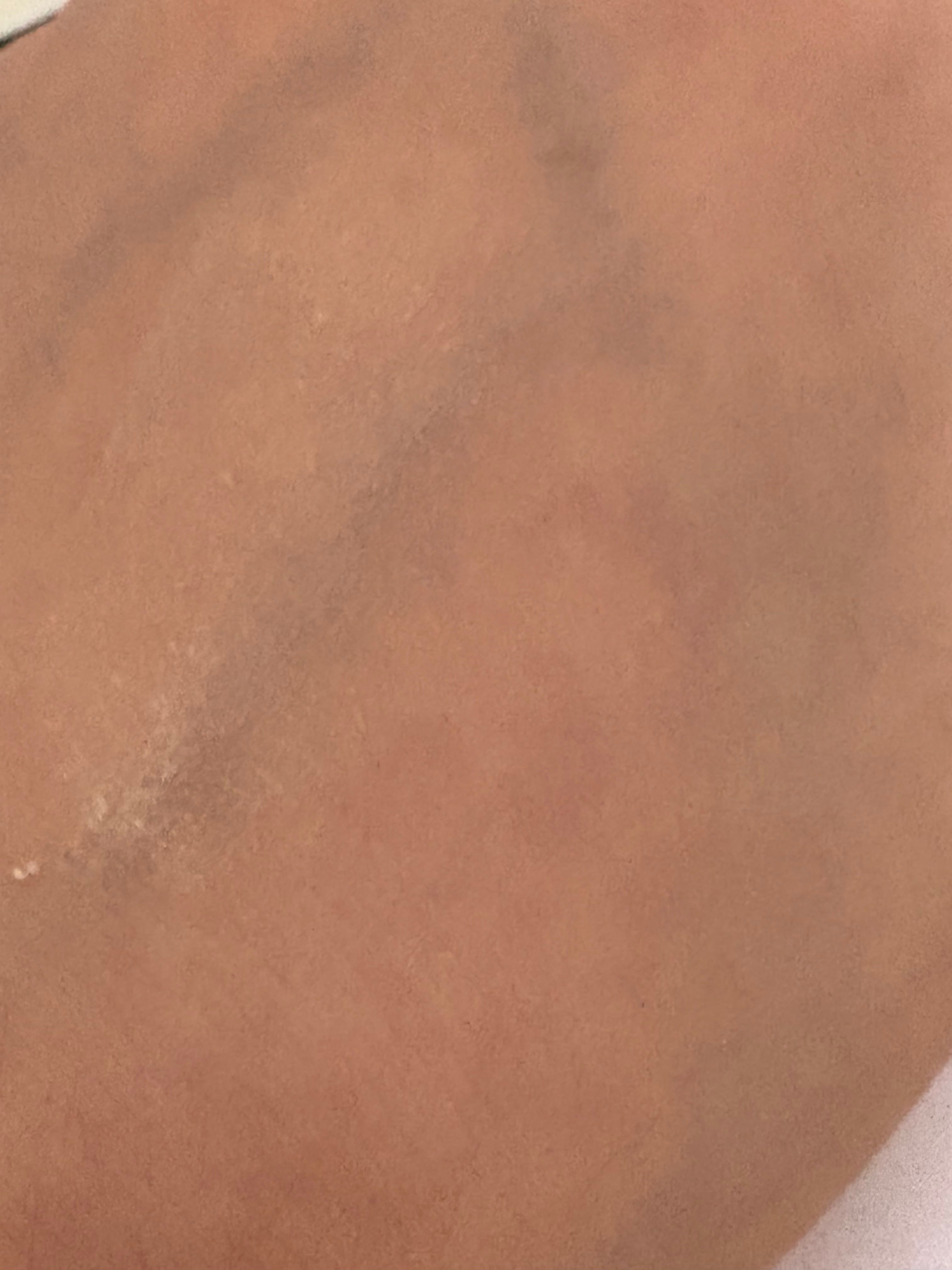Laura Mercier 柔光透明蜜粉 真實評價/實測照片 byw***u 1