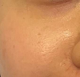 Olay 新生高效緊緻精華水 真實評價/實測照片 bycha**************com 1