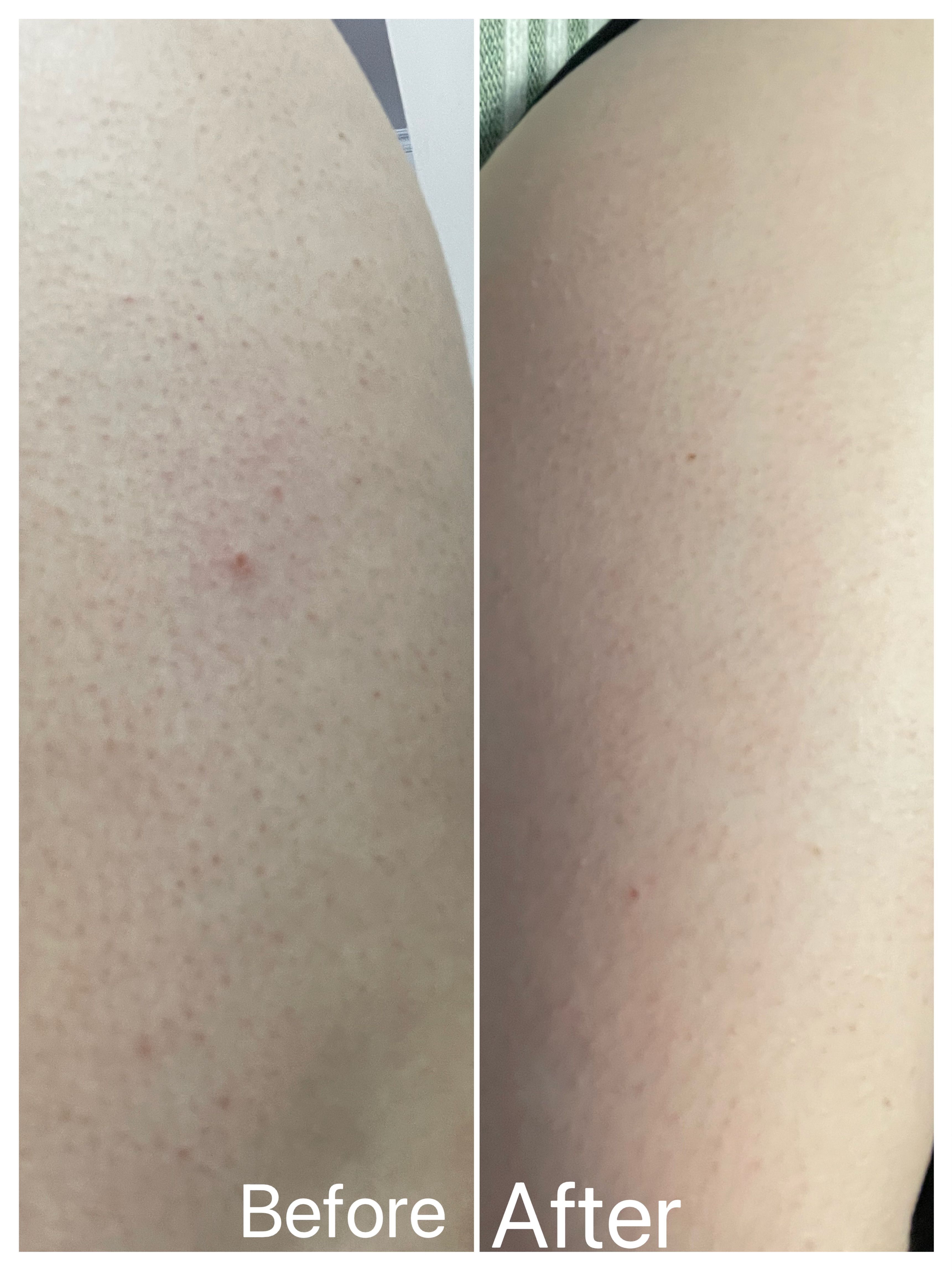 Dettol 滴露 ProSkin深層滋潤親膚沐浴乳霜 真實評價/實測照片 bySal****ang 1