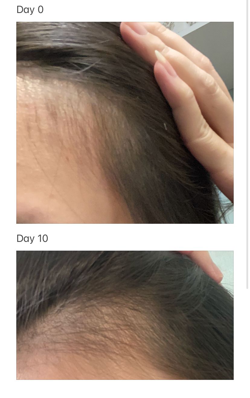 Vita Green 維特健靈 維新烏絲納米激活生髮洗髮精華露 真實評價/實測照片 byW**h 1