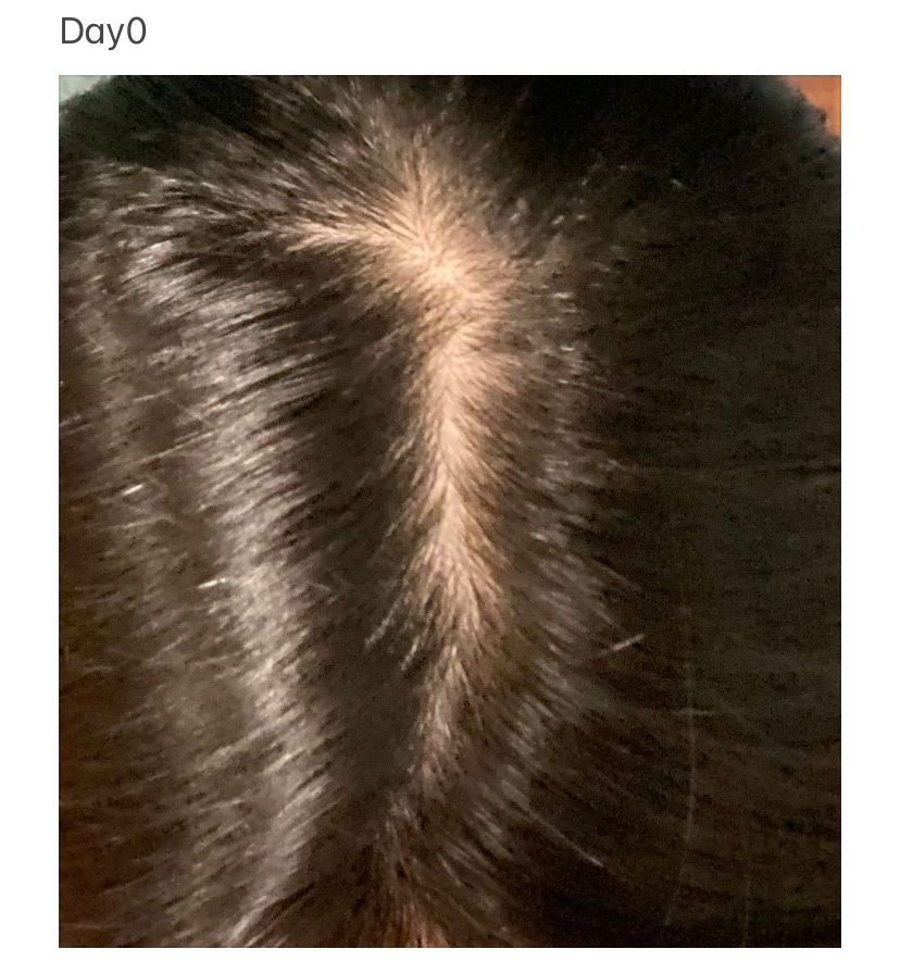 Vita Green 維特健靈 維新烏絲納米激活生髮洗髮精華露 真實評價/實測照片 byW**h 2