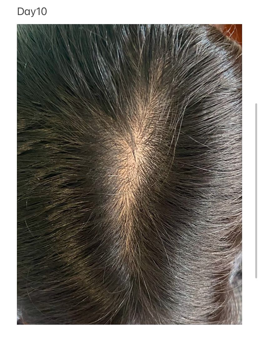 Vita Green 維特健靈 維新烏絲納米激活生髮洗髮精華露 真實評價/實測照片 byW**h 3