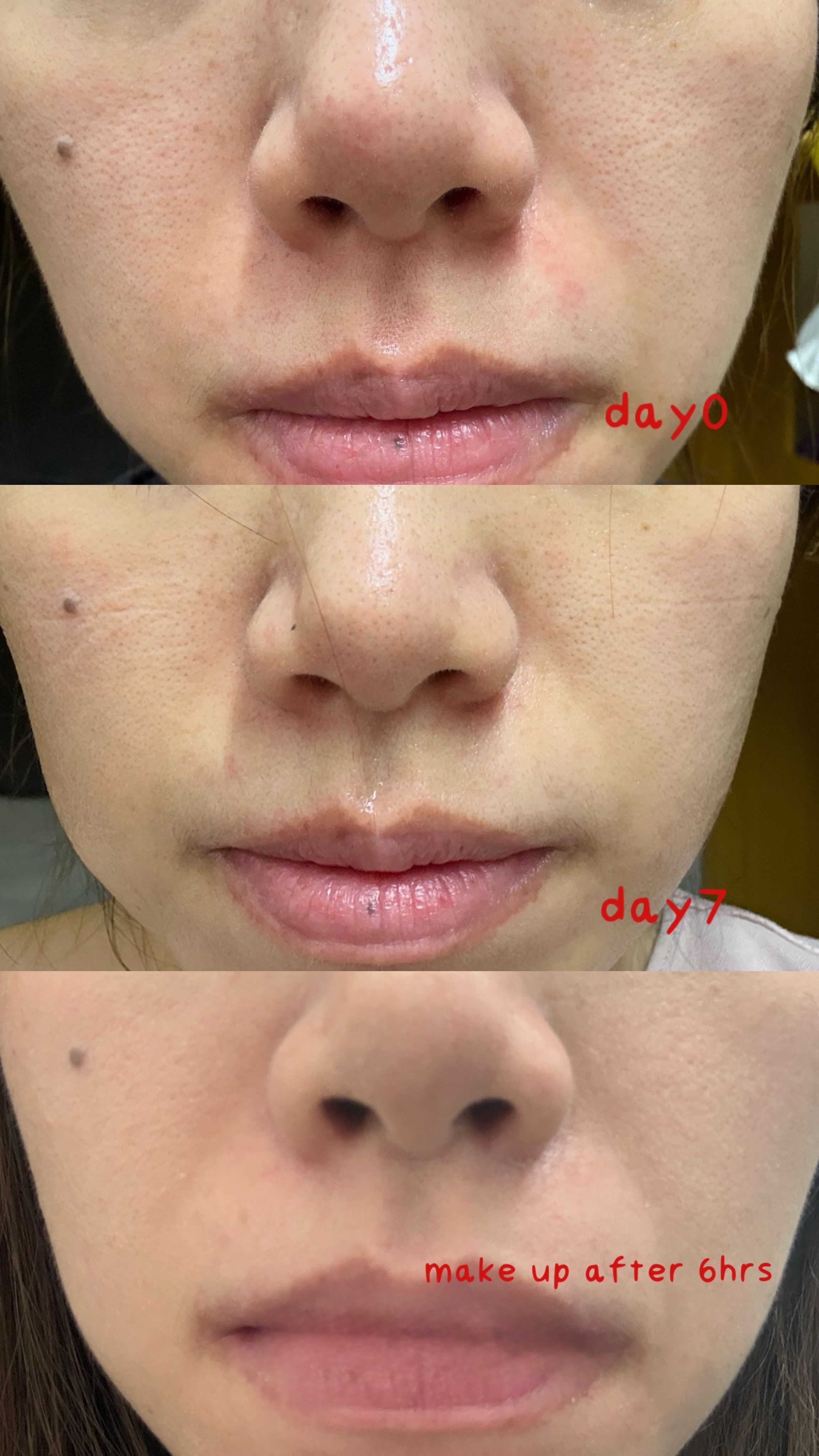 La Roche-Posay 極效修復面膜 真實評價/用後感 bylee*****************com 1 La Roche-Posay 極效修復面膜 真實評價/實測照片 bylee*****************com 1