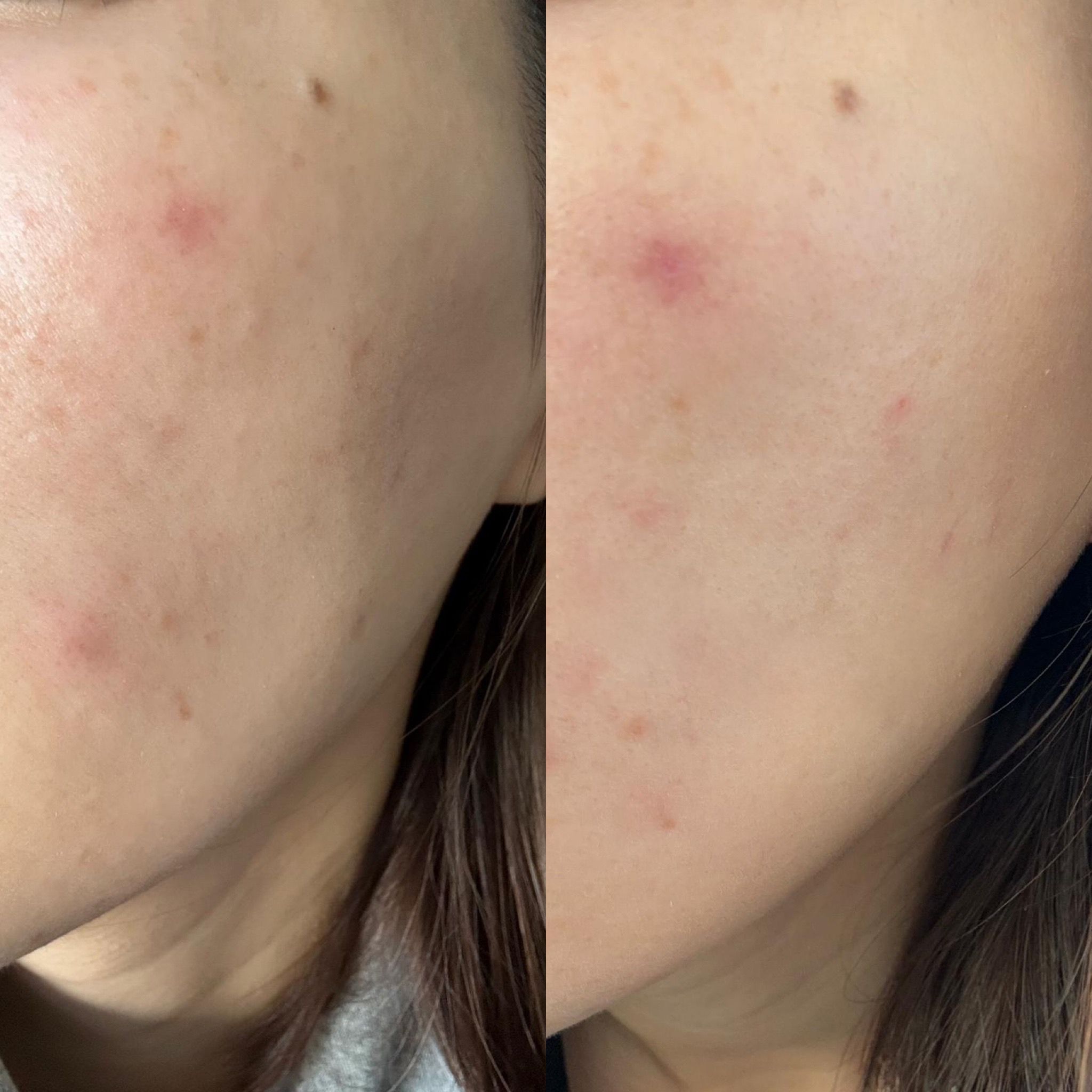 御容鑑 皇御秘方活養面霜 真實評價/實測照片 byzoe***************com 1