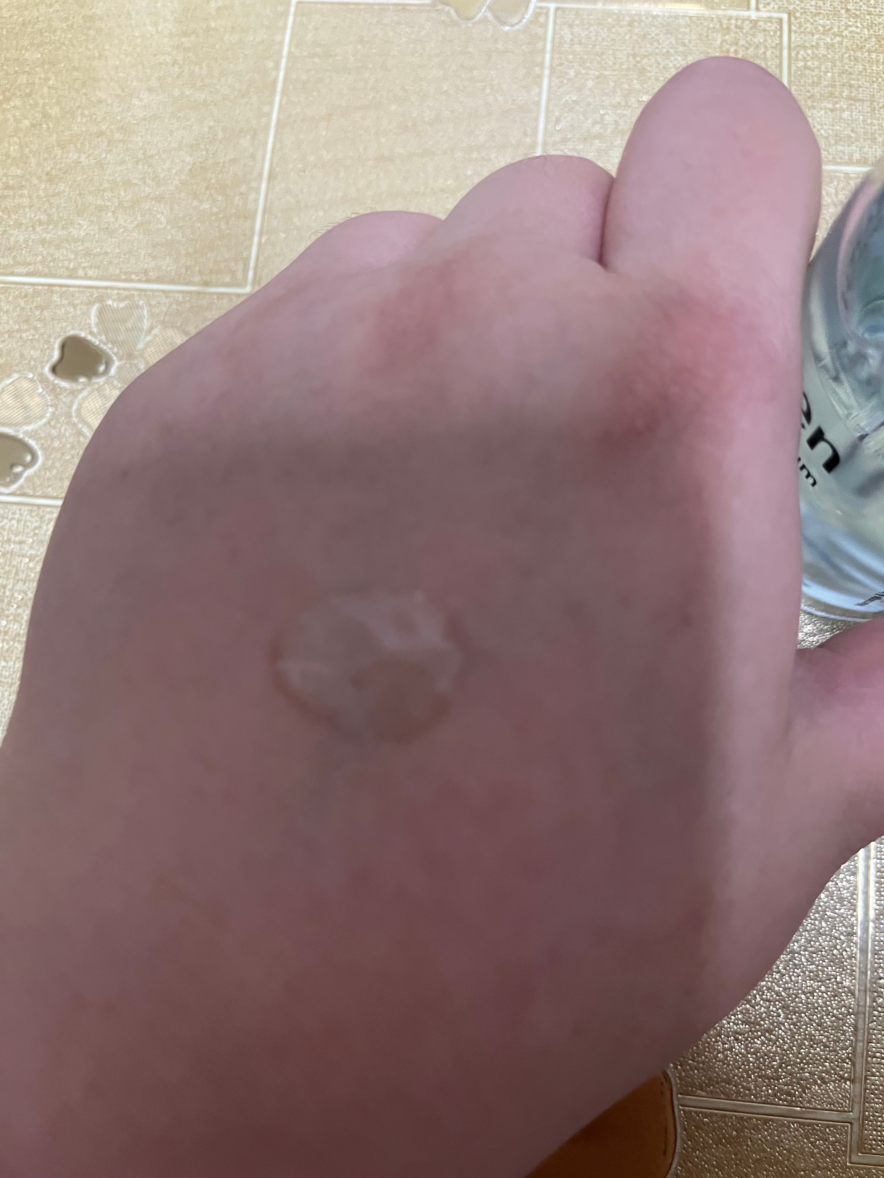Torriden 低分子玻尿酸精華 真實評價/實測照片 byQIN****ING 1