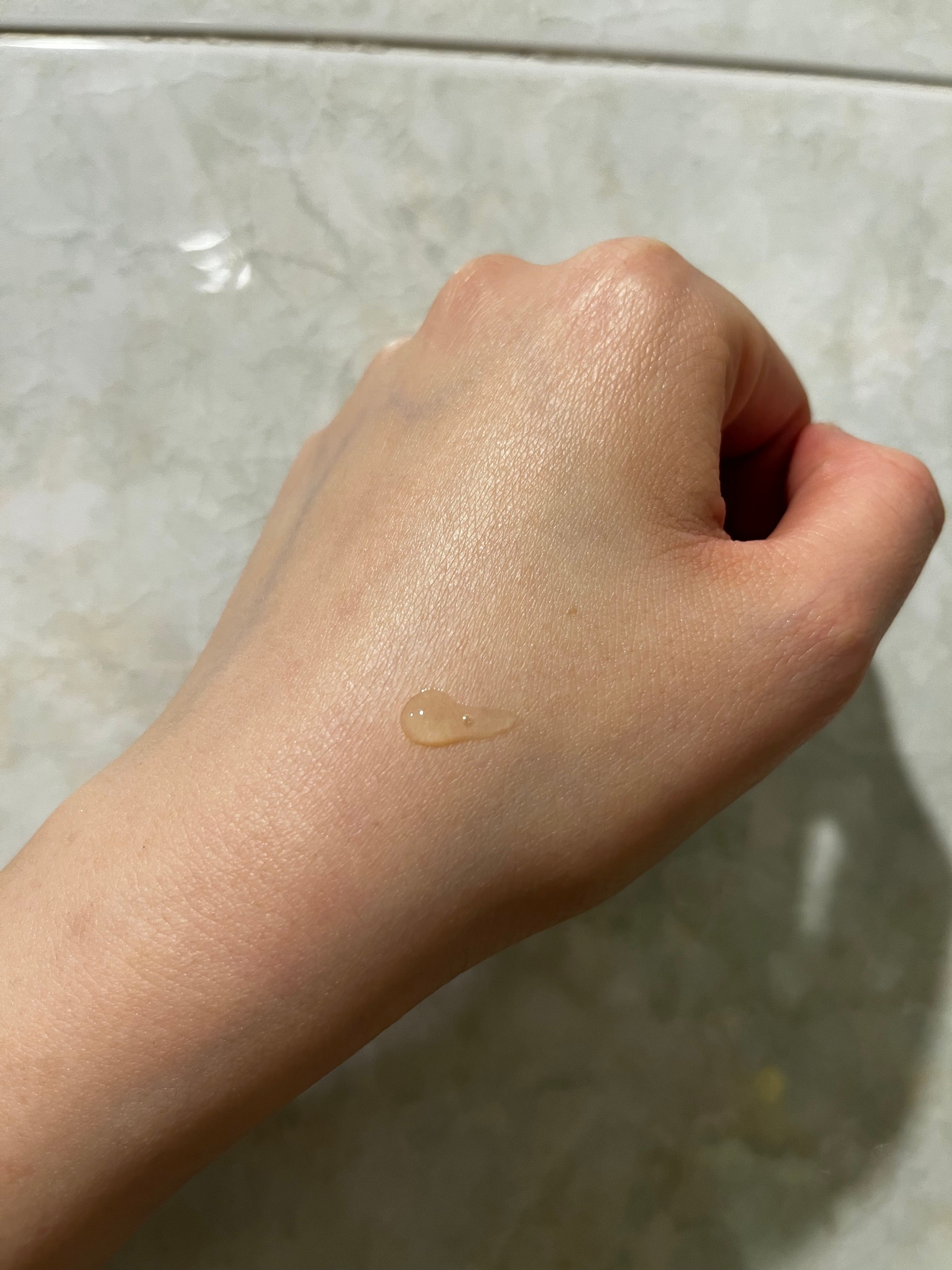 曼秀雷敦 Mentholatum 藥用暗瘡啫喱 真實評價/實測照片 byE**i 1