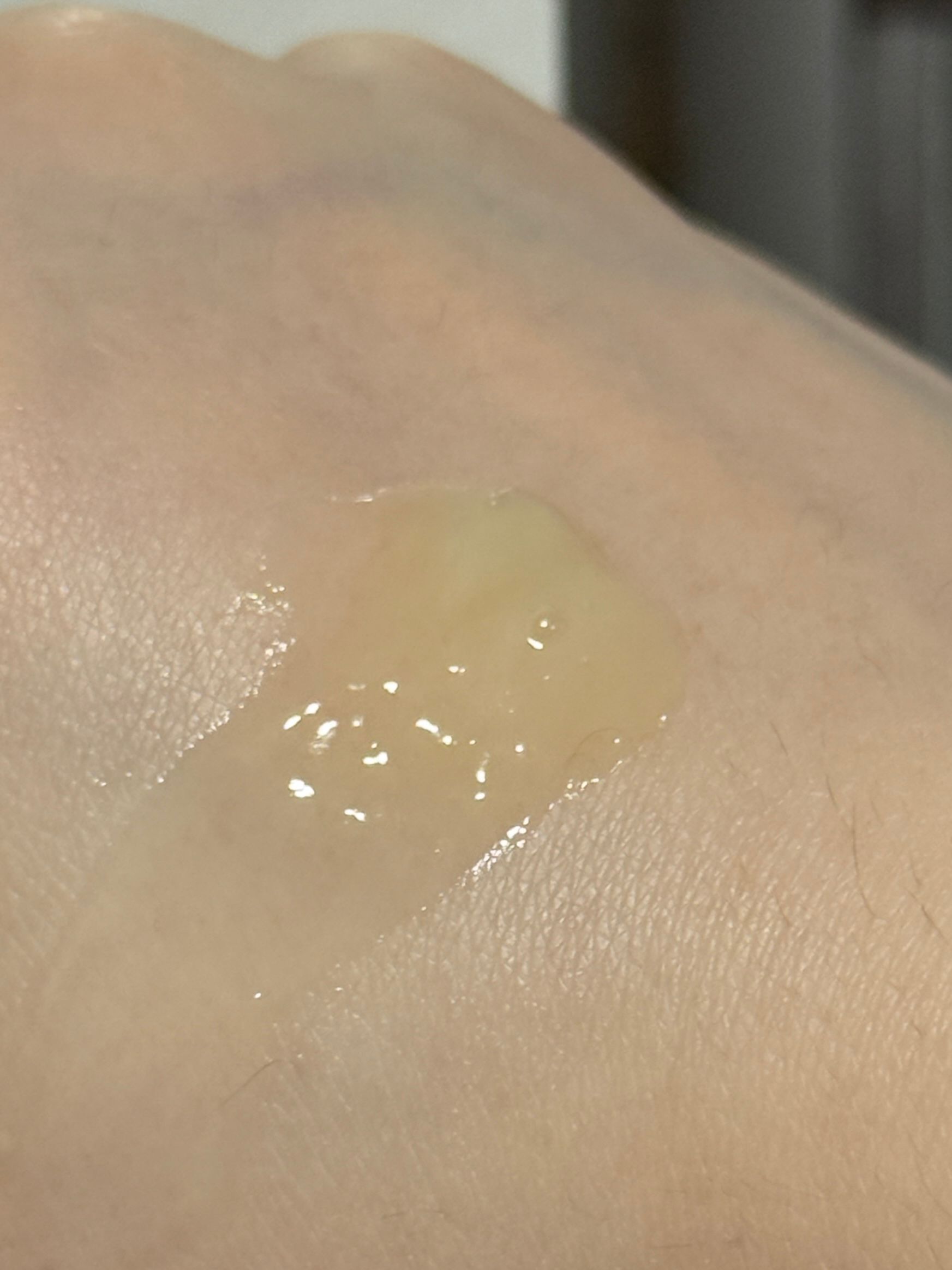 潘婷 Pantene 3分鐘奇蹟護髮精華素 - 多效損傷修護 Total damage care treatment 真實評價/用後感 byAtl**********ung 1 潘婷 Pantene 3分鐘奇蹟護髮精華素 - 多效損傷修護 Total damage care treatment 真實評價/實測照片 byAtl**********ung 1