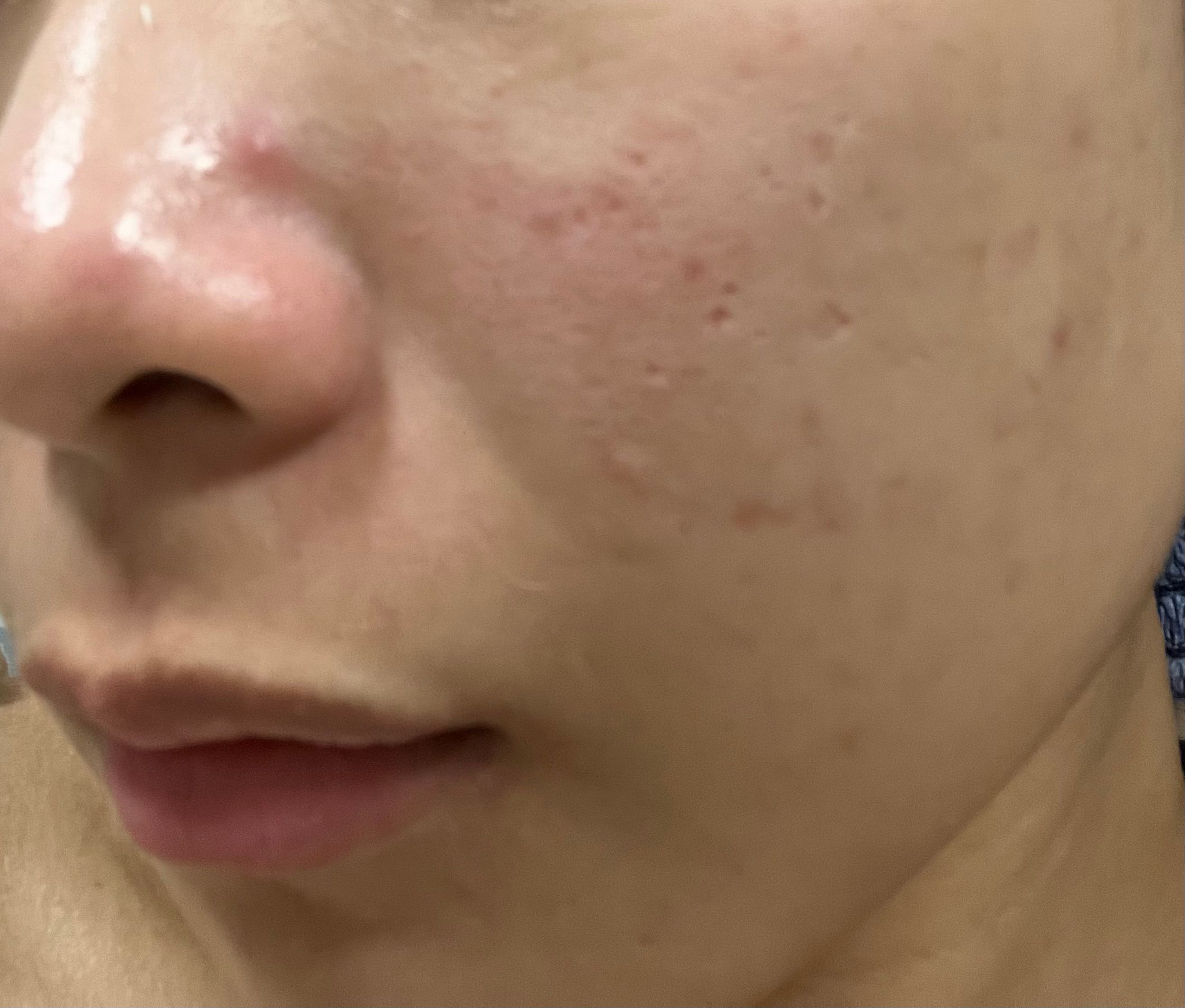 Typer PMS Care Mask 真實評價/實測照片 byRon***Lai 1