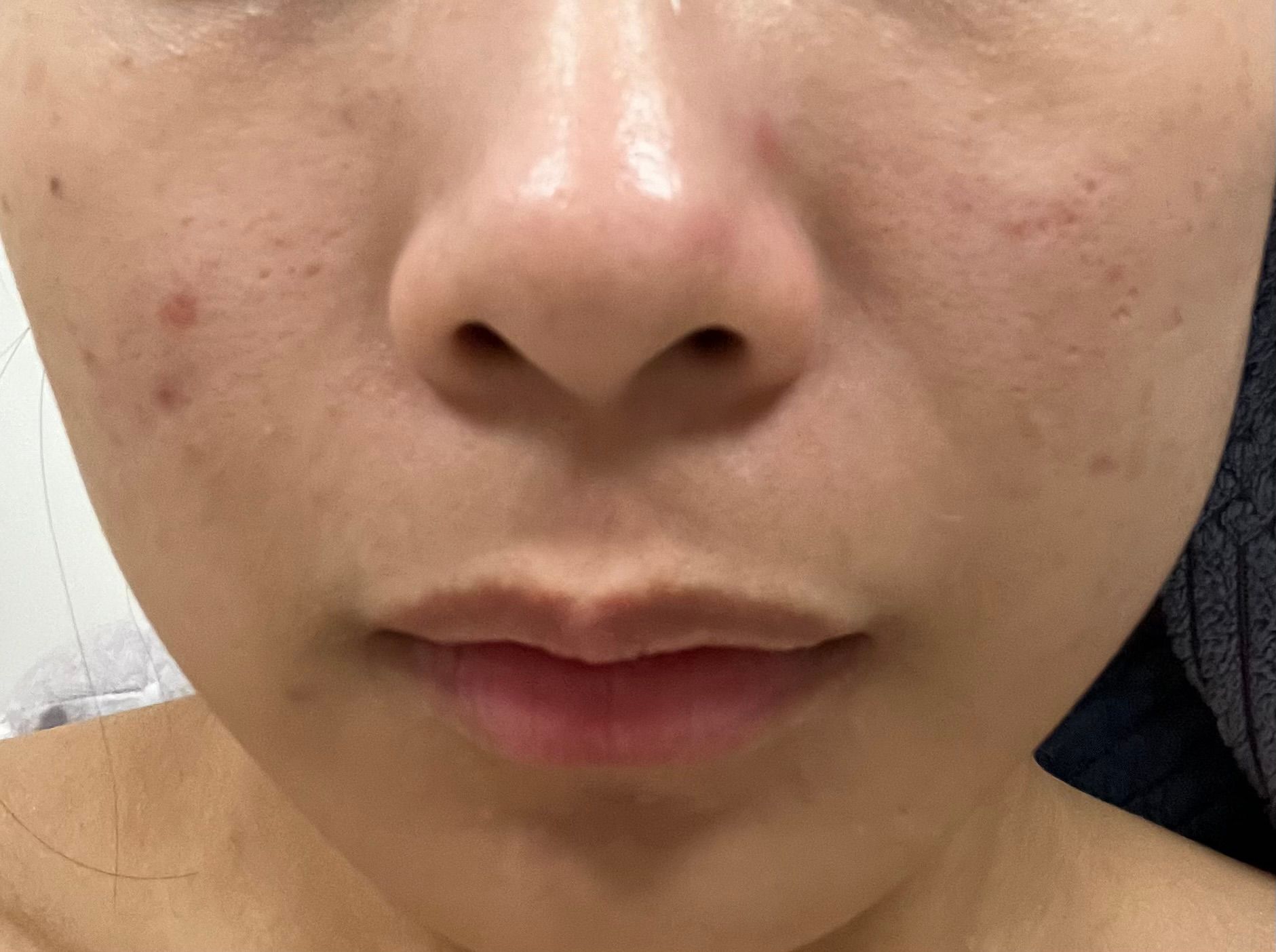 Typer PMS Care Mask 真實評價/實測照片 byRon***Lai 3