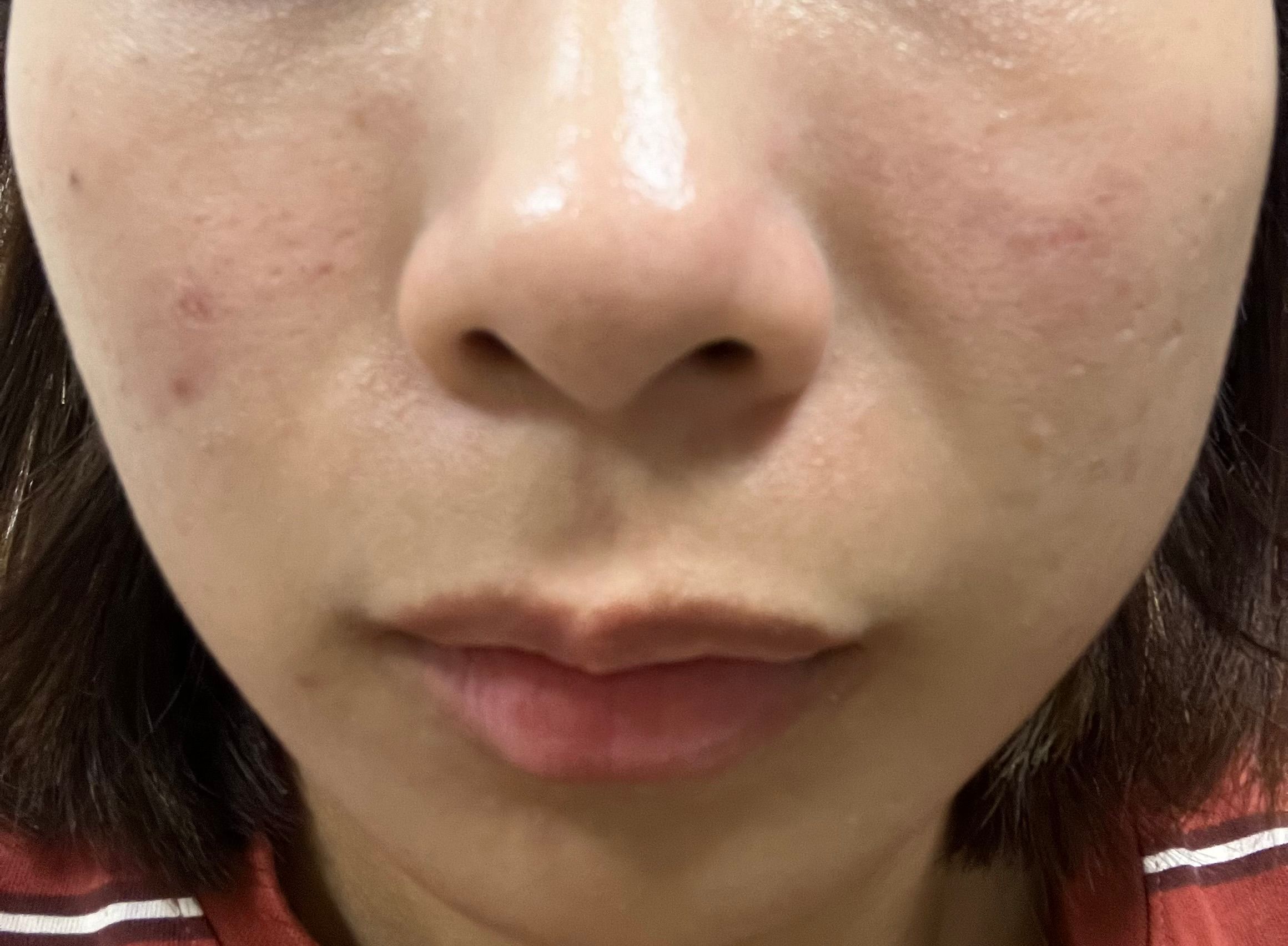 Typer PMS Care Mask 真實評價/實測照片 byRon***Lai 2
