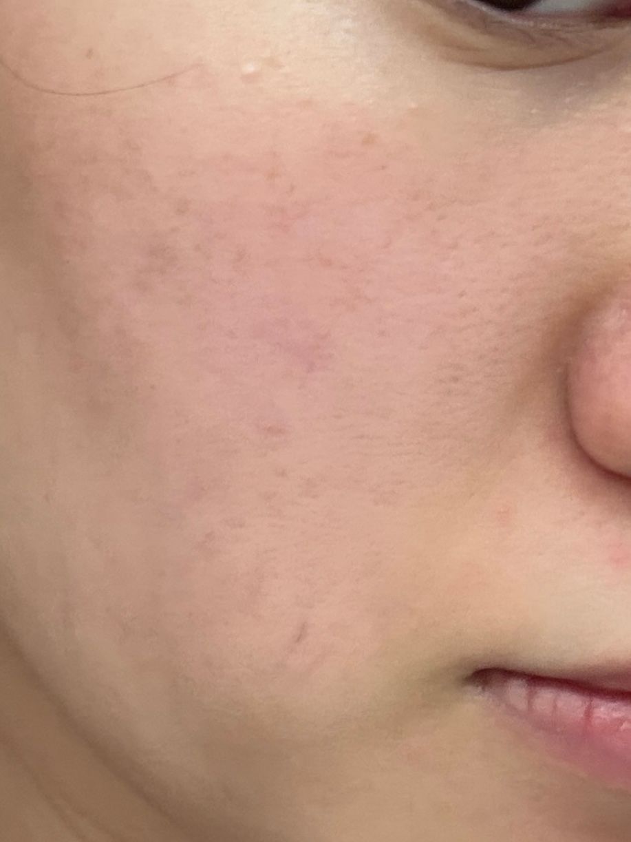 Sasatinnie 第三代升級版全效水潤透光面膜 真實評價/實測照片 byemm***111 2