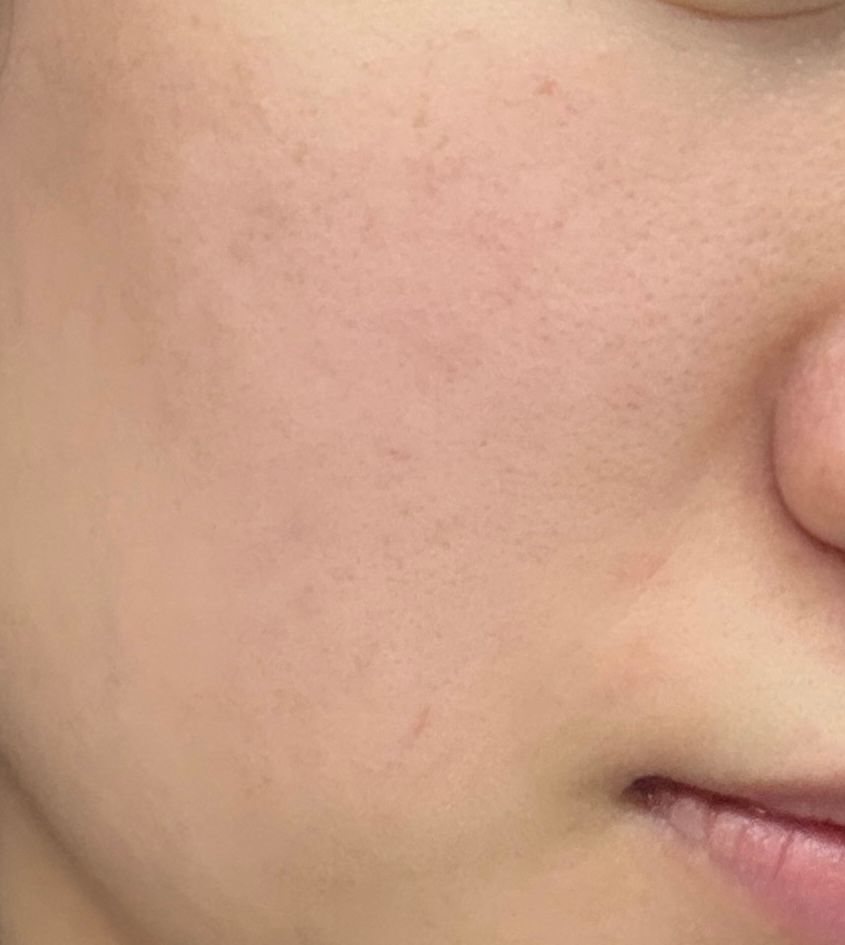 Sasatinnie 第三代升級版全效水潤透光面膜 真實評價/實測照片 byemm***111 1