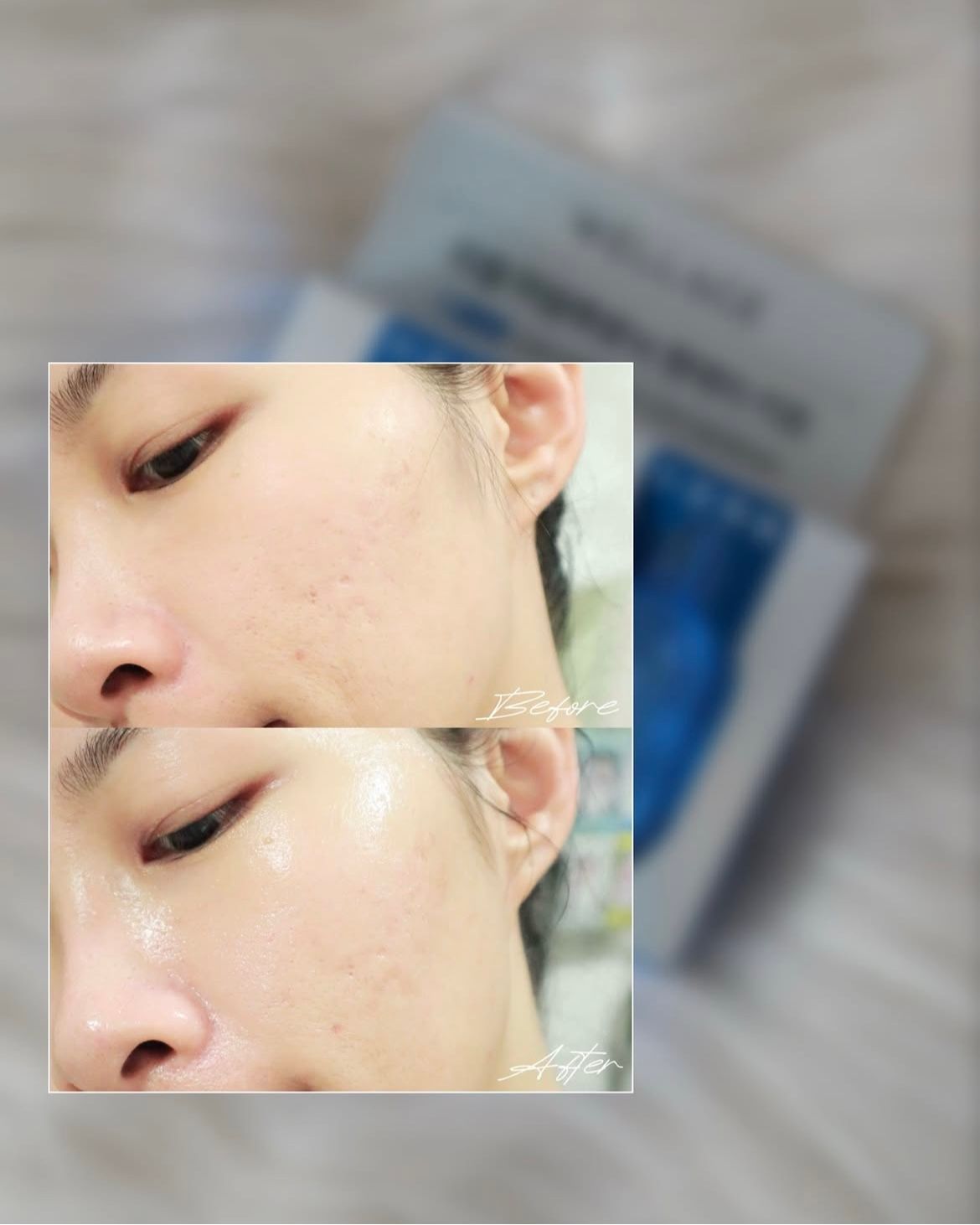 WELLAGE 唯拉珠 高濃縮玻尿酸精華球 (高濃度透明質酸一天水光保濕急救精華膠囊) 真實評價/實測照片 byl***i 1