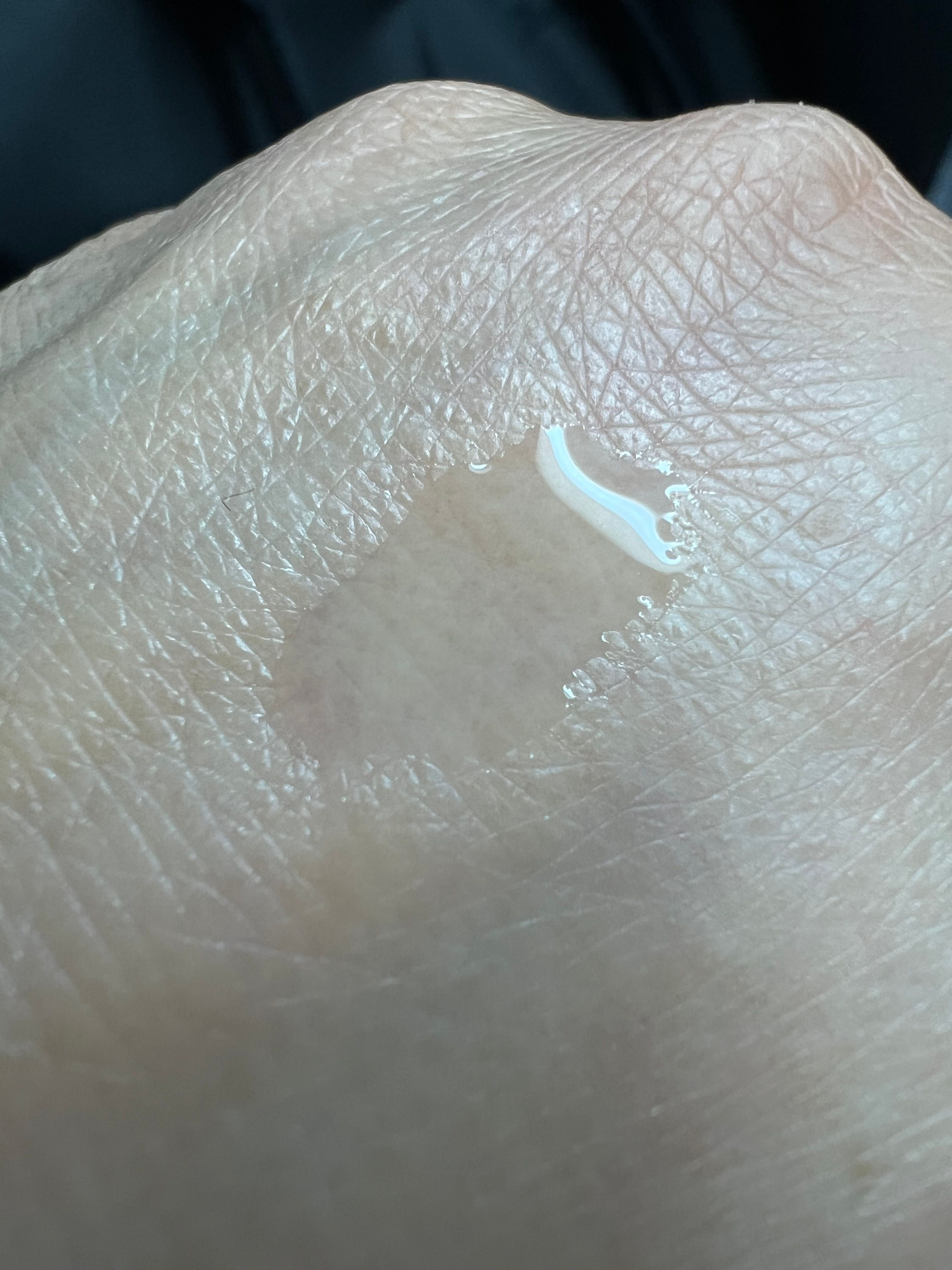 雪肌精 藥用雪肌精化妝水 真實評價/實測照片 bymar*****************com 1