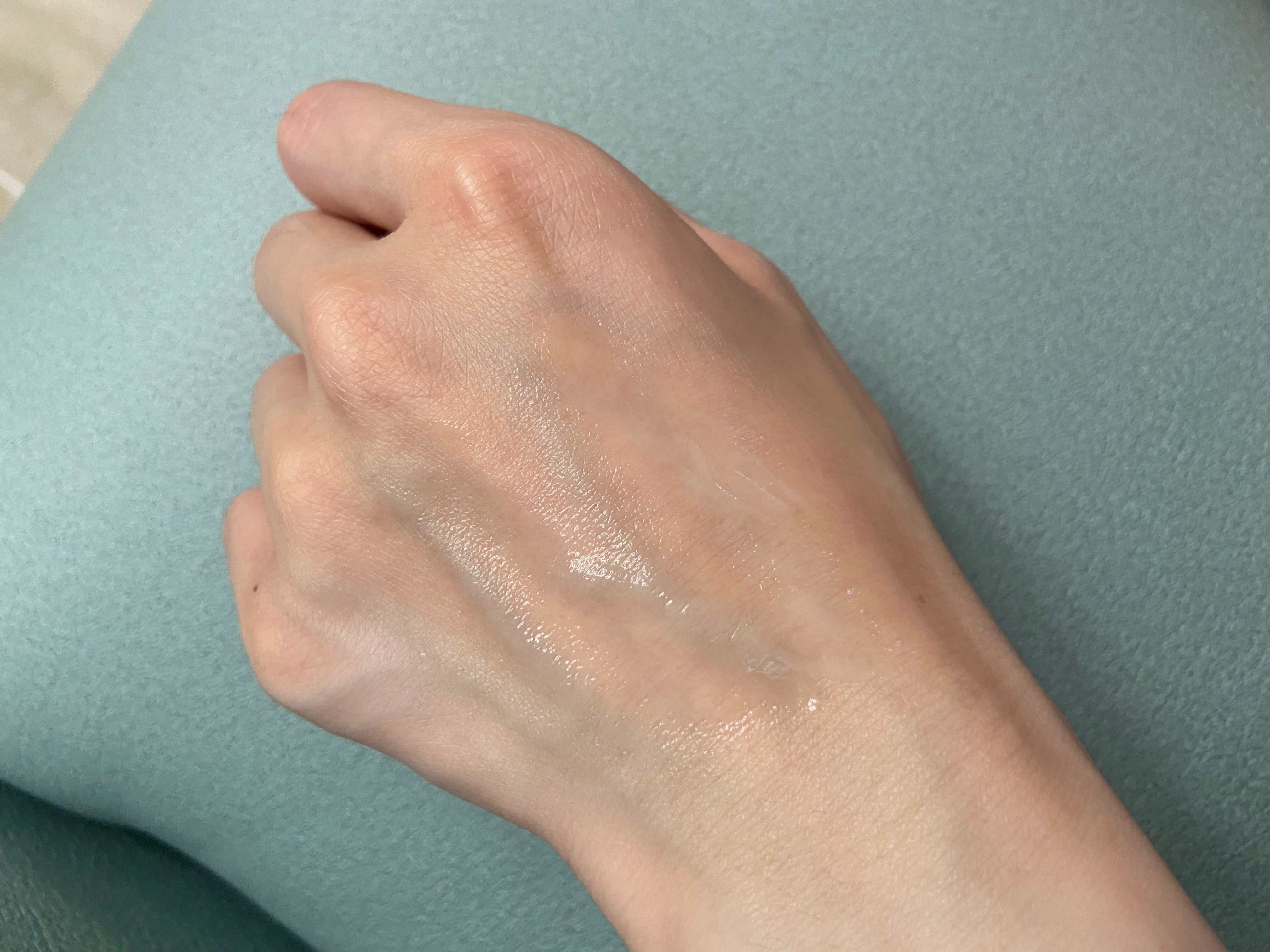 Andlab 零害美肌水滴面膜 真實評價/實測照片 byLov*****ing 1