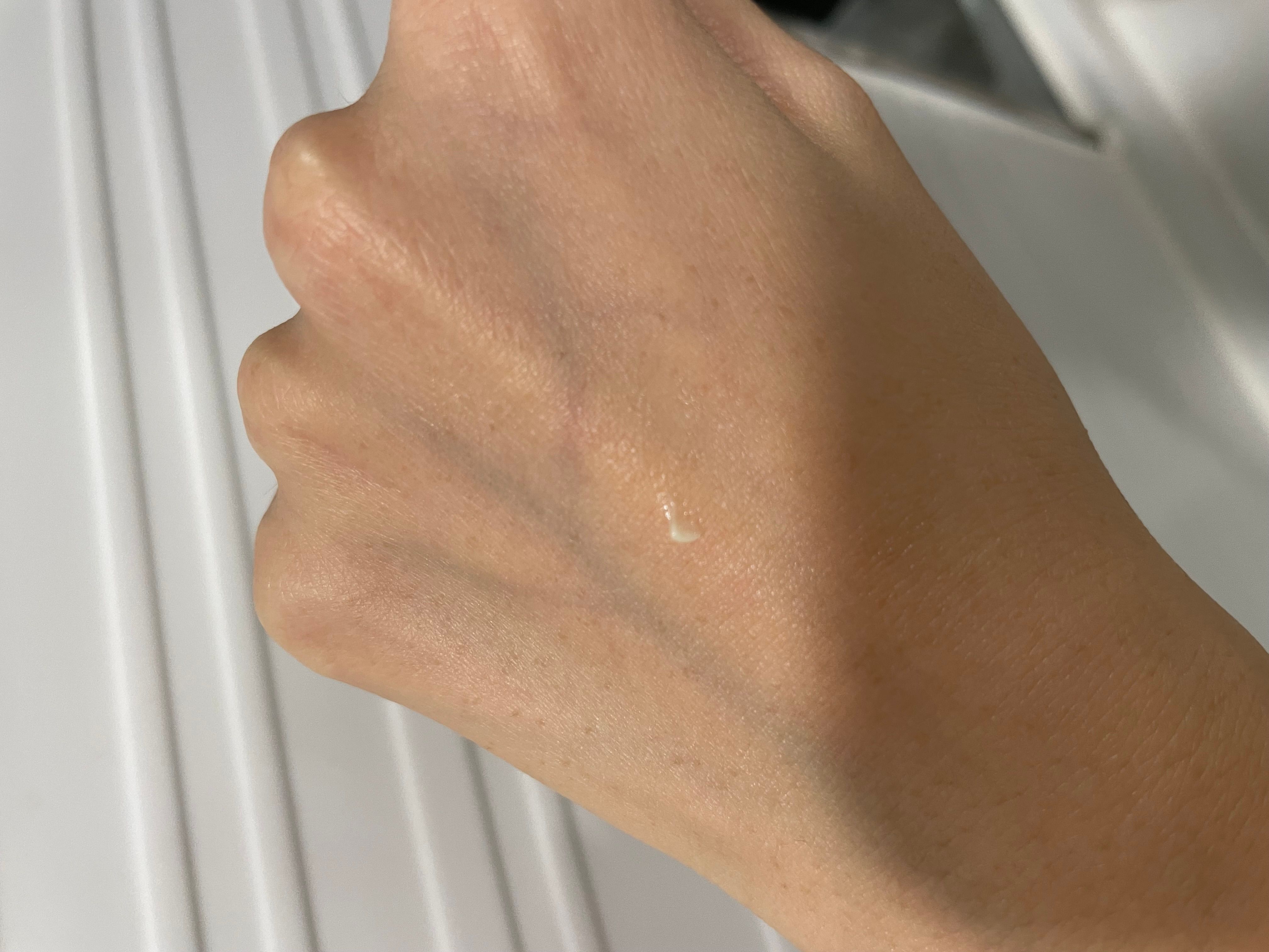 白兔牌 白兔牌暗瘡膏 真實評價/實測照片 byBl****ng 1