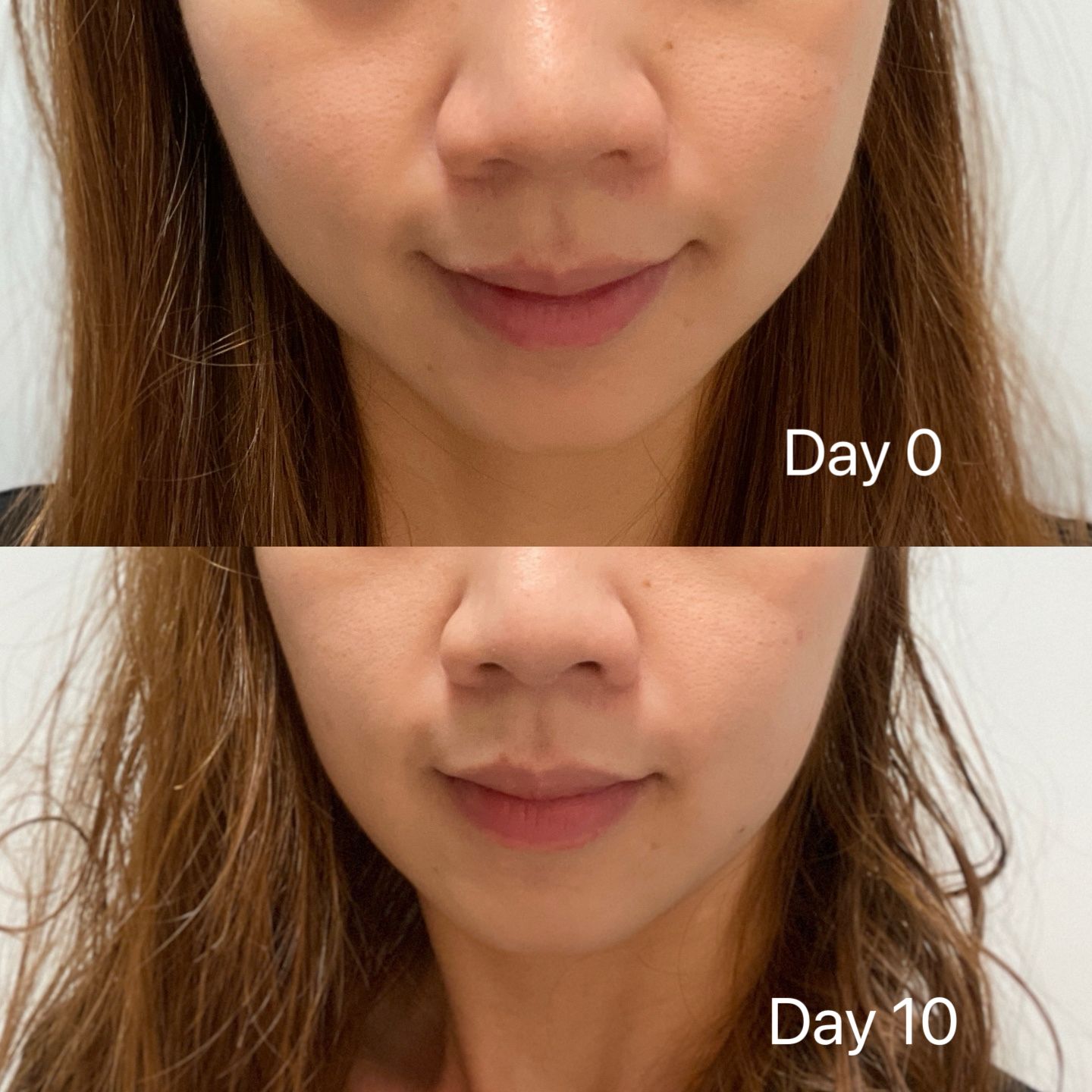 Olay 水感透白光曜精華 真實評價/用後感 bykat***************com 1 Olay 水感透白光曜精華 真實評價/實測照片 bykat***************com 1