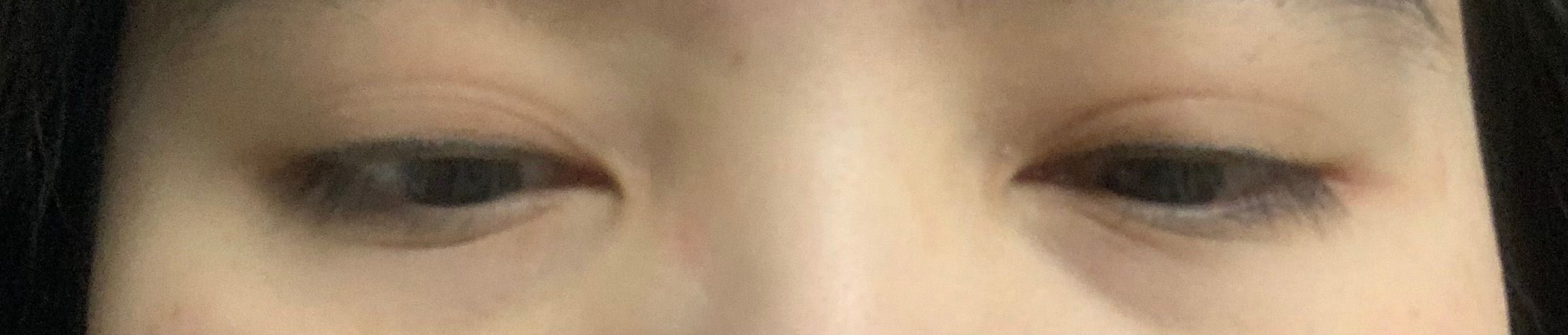 AHC 醫美科研水光導入玻尿酸全臉眼霜 真實評價/用後感 byemm********************.hk 1 AHC 醫美科研水光導入玻尿酸全臉眼霜 真實評價/實測照片 byemm********************.hk 1