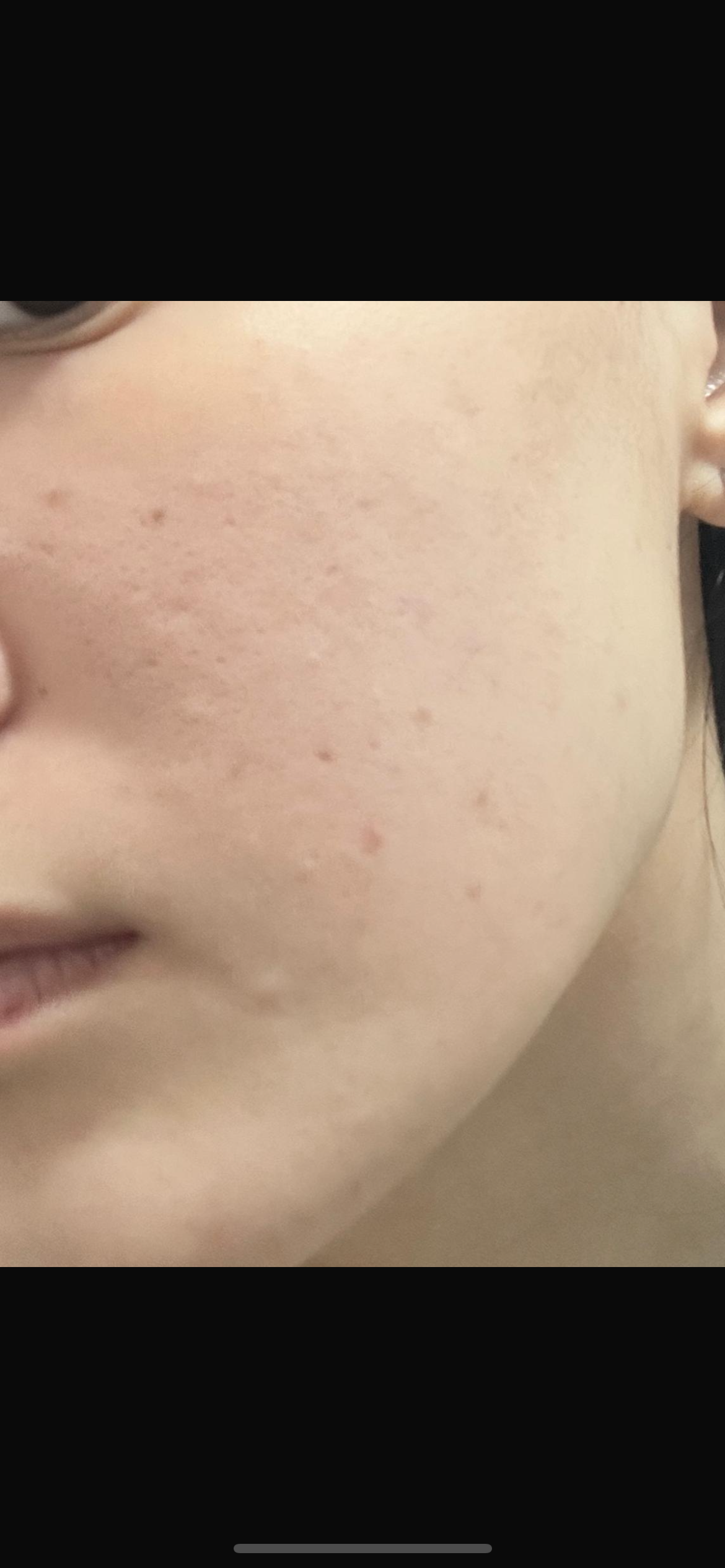 Sasatinnie 第三代升級版全效水潤透光面膜 真實評價/實測照片 bymo***oi 2