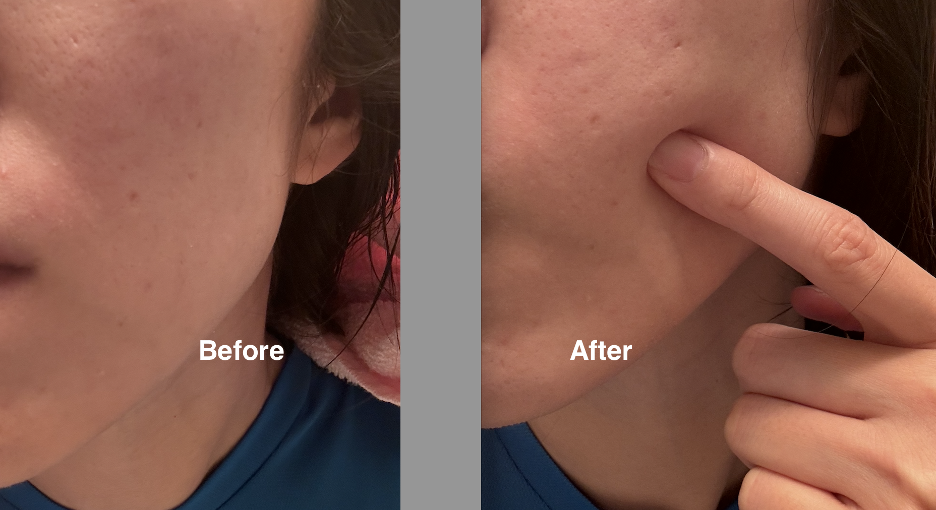 The Ordinary 透明質酸+B5補水精華 真實評價/用後感 bySi***Wa 2 The Ordinary 透明質酸+B5補水精華 真實評價/實測照片 bySi***Wa 2