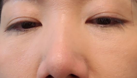 Benefit Cosmetics Boi-ing提采明亮遮瑕膏 真實評價/用後感 byLin****ana 1 Benefit Cosmetics Boi-ing提采明亮遮瑕膏 真實評價/實測照片 byLin****ana 1