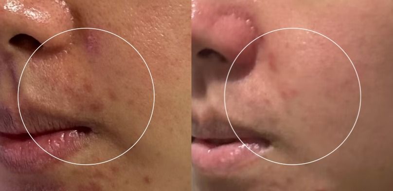 Typer PMS Care Mask 真實評價/實測照片 by品牌提供 1