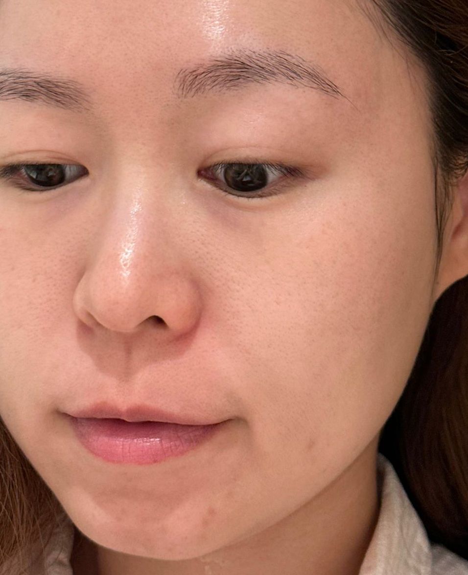 Sasatinnie 第三代升級版全效水潤透光面膜 真實評價/實測照片 byMom***ong 1