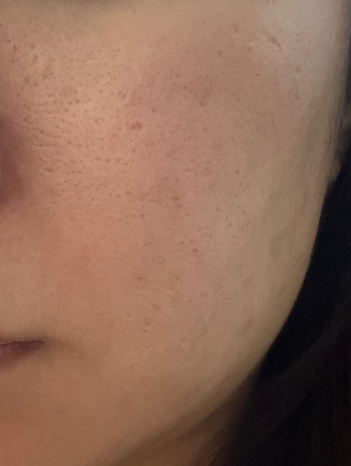 CeraVe 活肌再生A醇抗皺精華 真實評價/用後感 bycla**************com 1 CeraVe 活肌再生A醇抗皺精華 真實評價/實測照片 bycla**************com 1