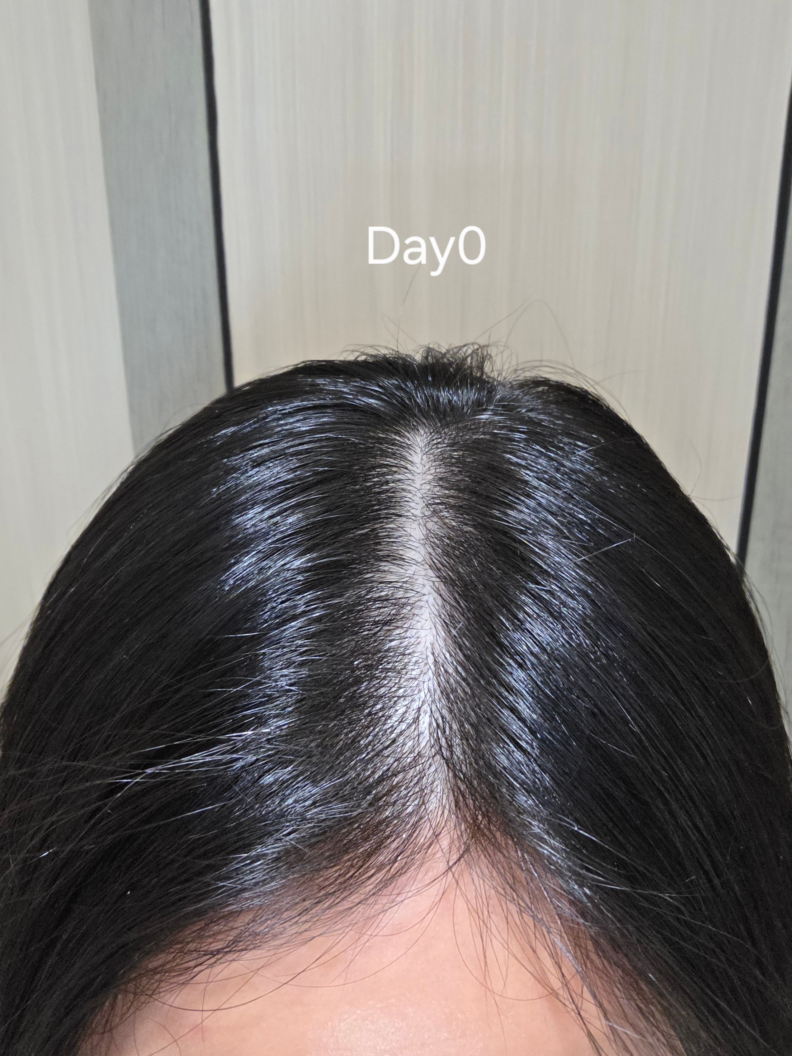 YUTAKANA豐盛生活 煥髮奇蹟生髮潤黑激活精華噴霧 真實評價/實測照片 byAnn****wok 2