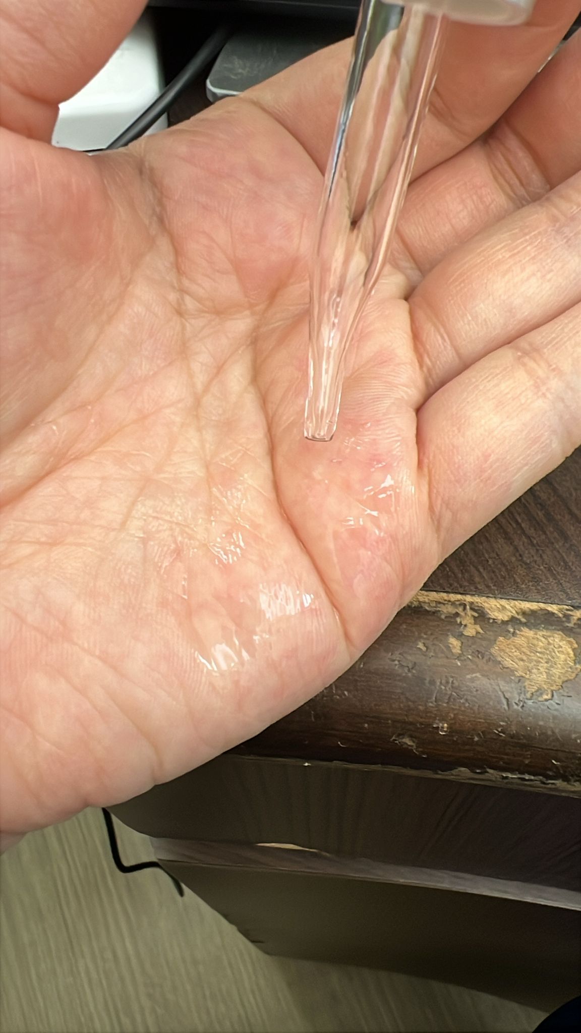 Atorrege AD+ 深層保濕精華 真實評價/實測照片 bycat*****************com 1