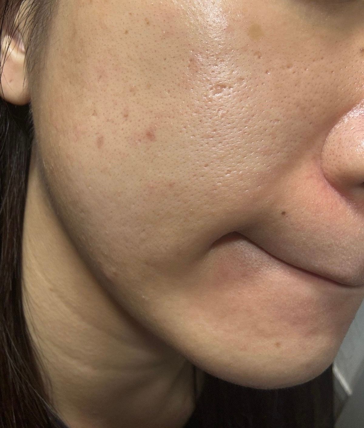 Skin Need 05I 白藜蘆醇A醇面霜 真實評價/實測照片 byy*y 2