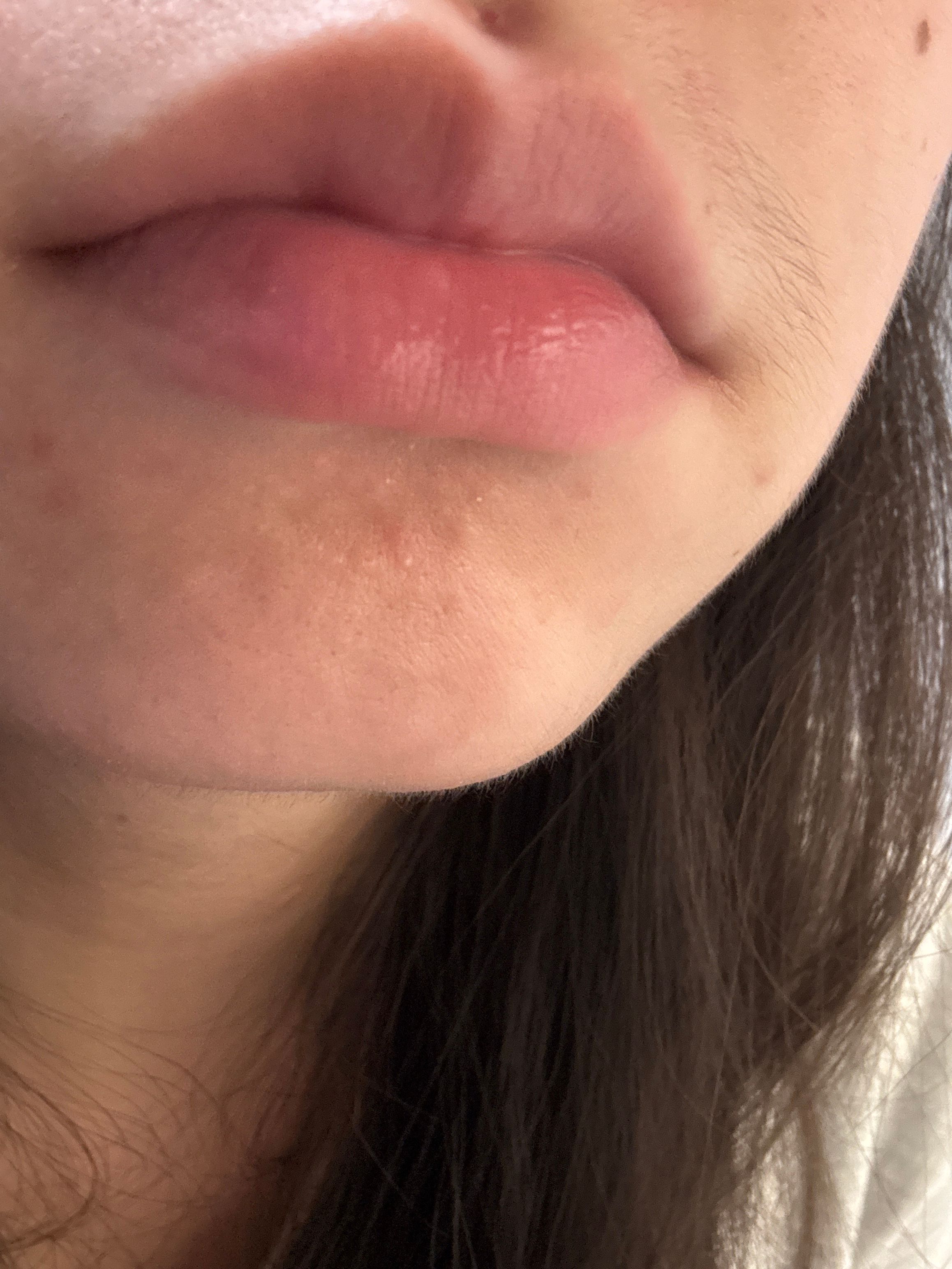 曼秀雷敦 Mentholatum Lip Ice水果潤唇膏 真實評價/實測照片 bytsu************com 1