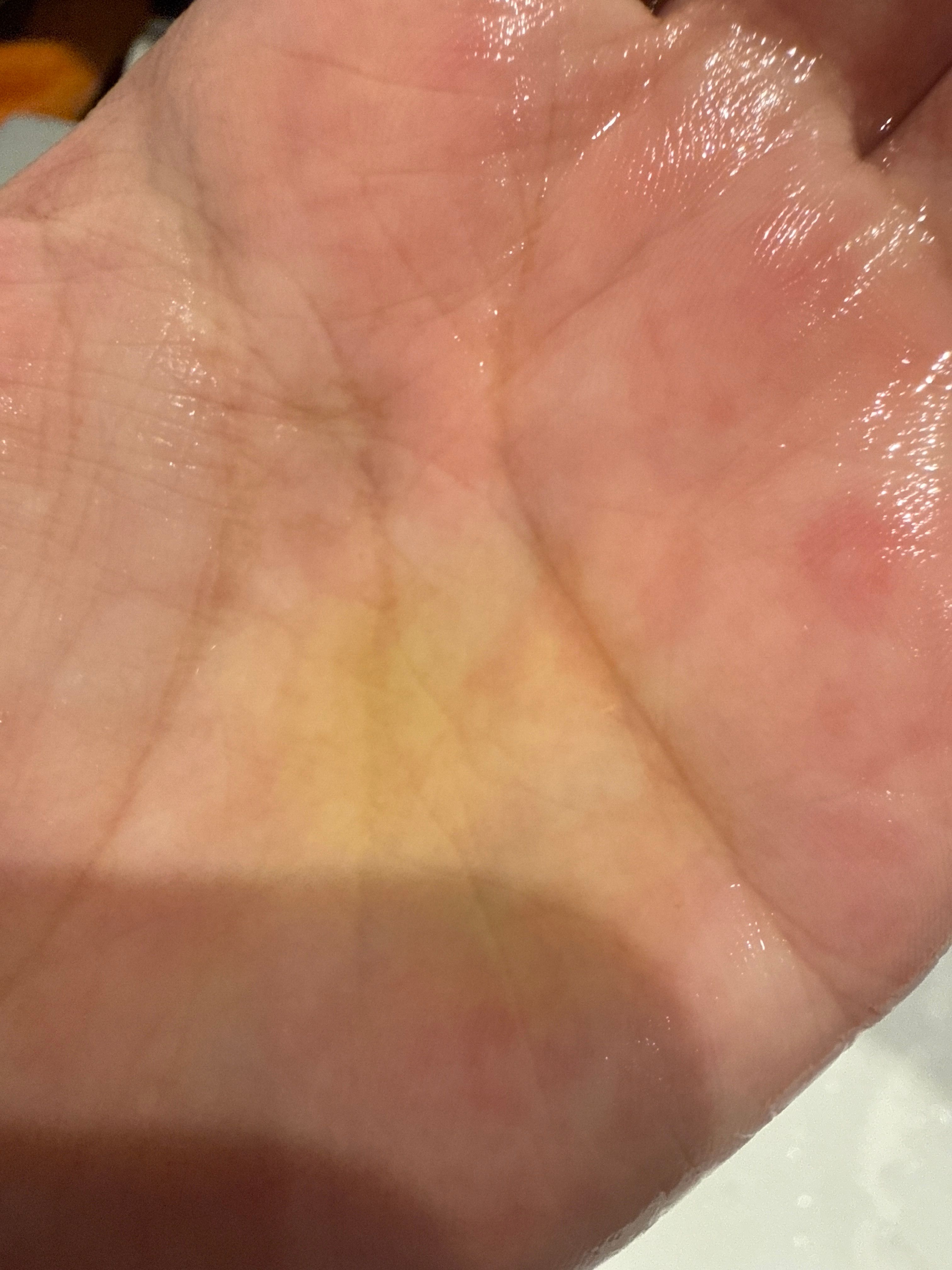 The Body Shop 茶樹淨肌潔面啫喱 真實評價/實測照片 byH***n 1