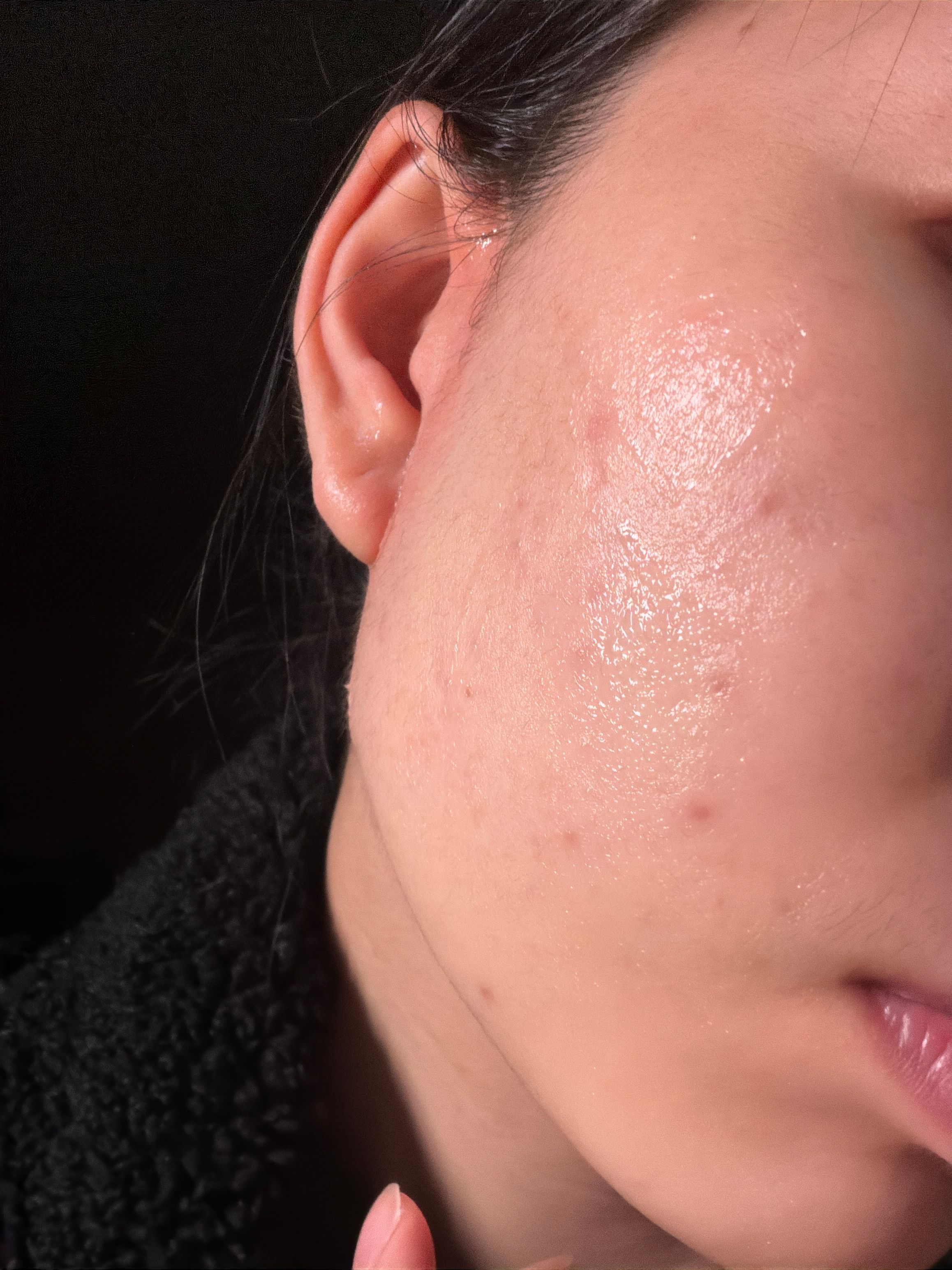 Medicube Age- R專用導入凝膠 真實評價/實測照片 byPig**********die 1