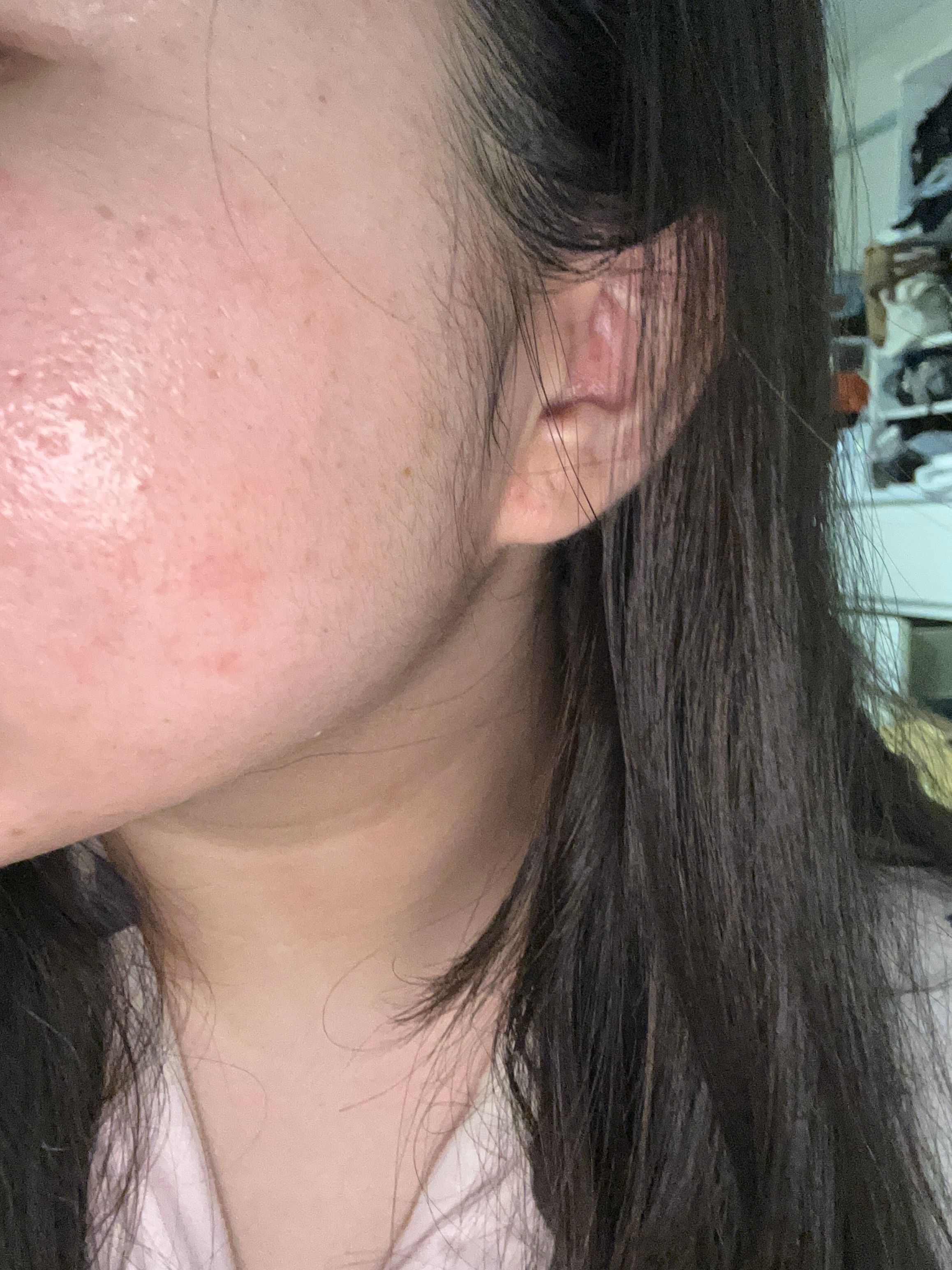 Avene 抗敏活泉水 真實評價/實測照片 by201*****************com 1
