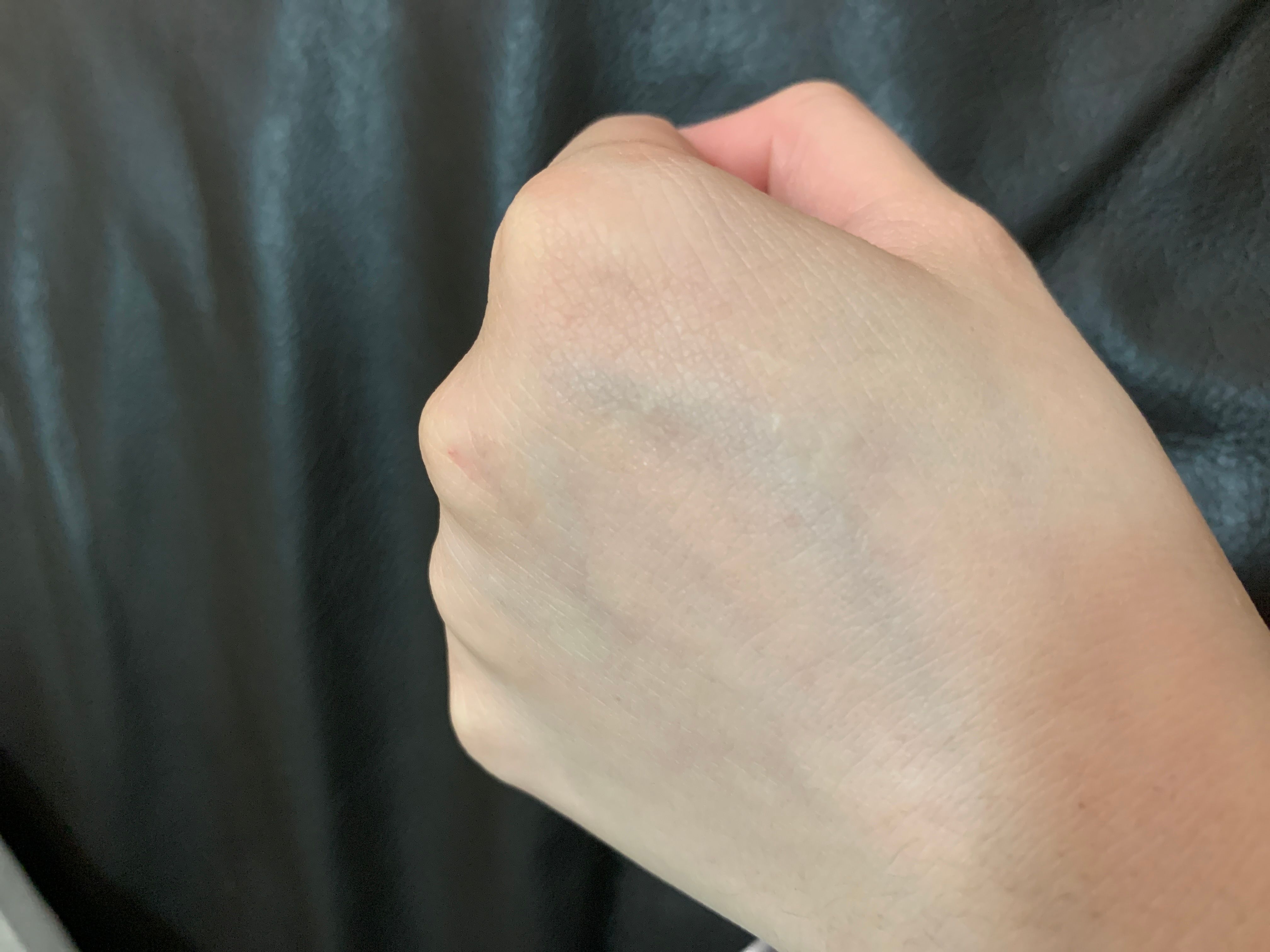 Lancome Genifique 嫩肌活膚精華(小黑瓶) 真實評價/用後感 byLaj******a22 1 Lancome Genifique 嫩肌活膚精華(小黑瓶) 真實評價/實測照片 byLaj******a22 1